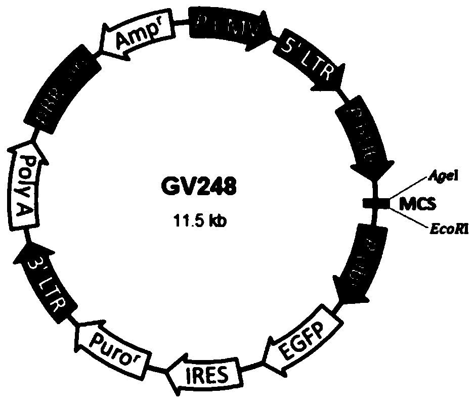 SiRNA for targeted inhibition of EGFL9 gene expression, siRNA plasmid, lentivirus, construction method of lentivirus, and application of SiRNA, siRNA plasmid and lentivirus