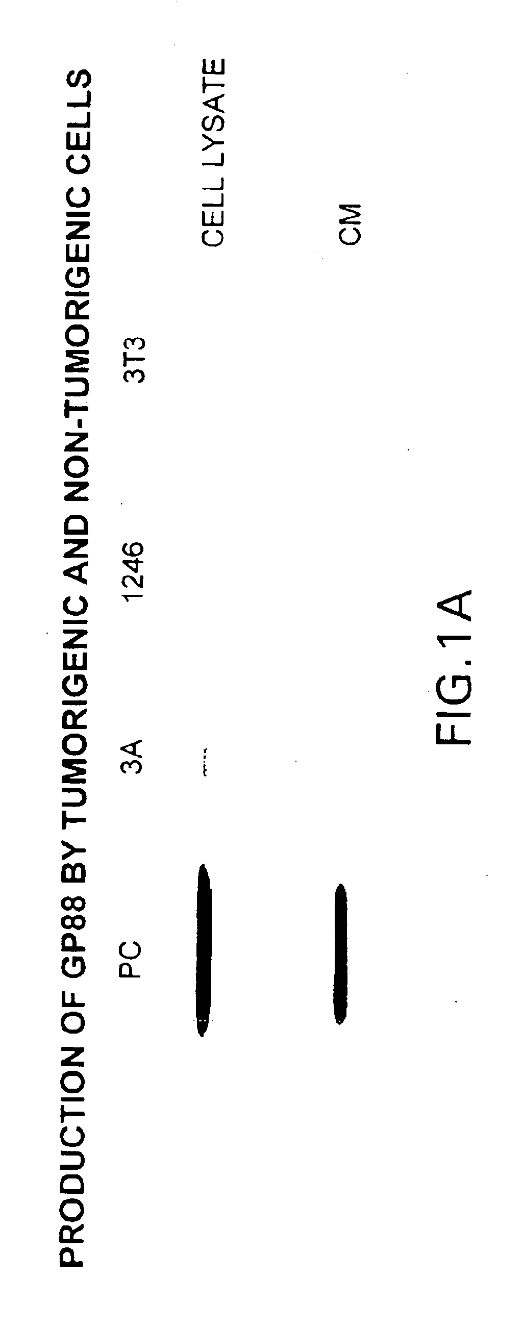 Methods and kits for diagnosing tumorigenicity and determining resistance to the antineoplastic effects of antiestrogen therapy