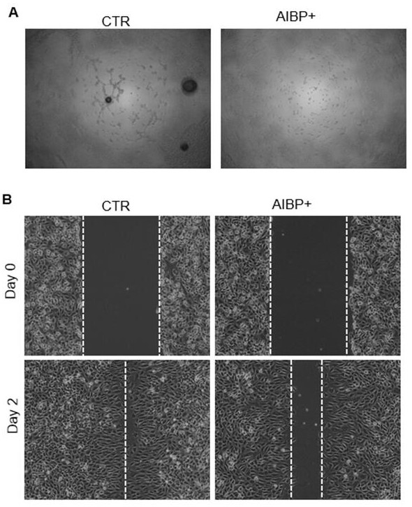 Application of AIBP in treating or inhibiting hemangioma