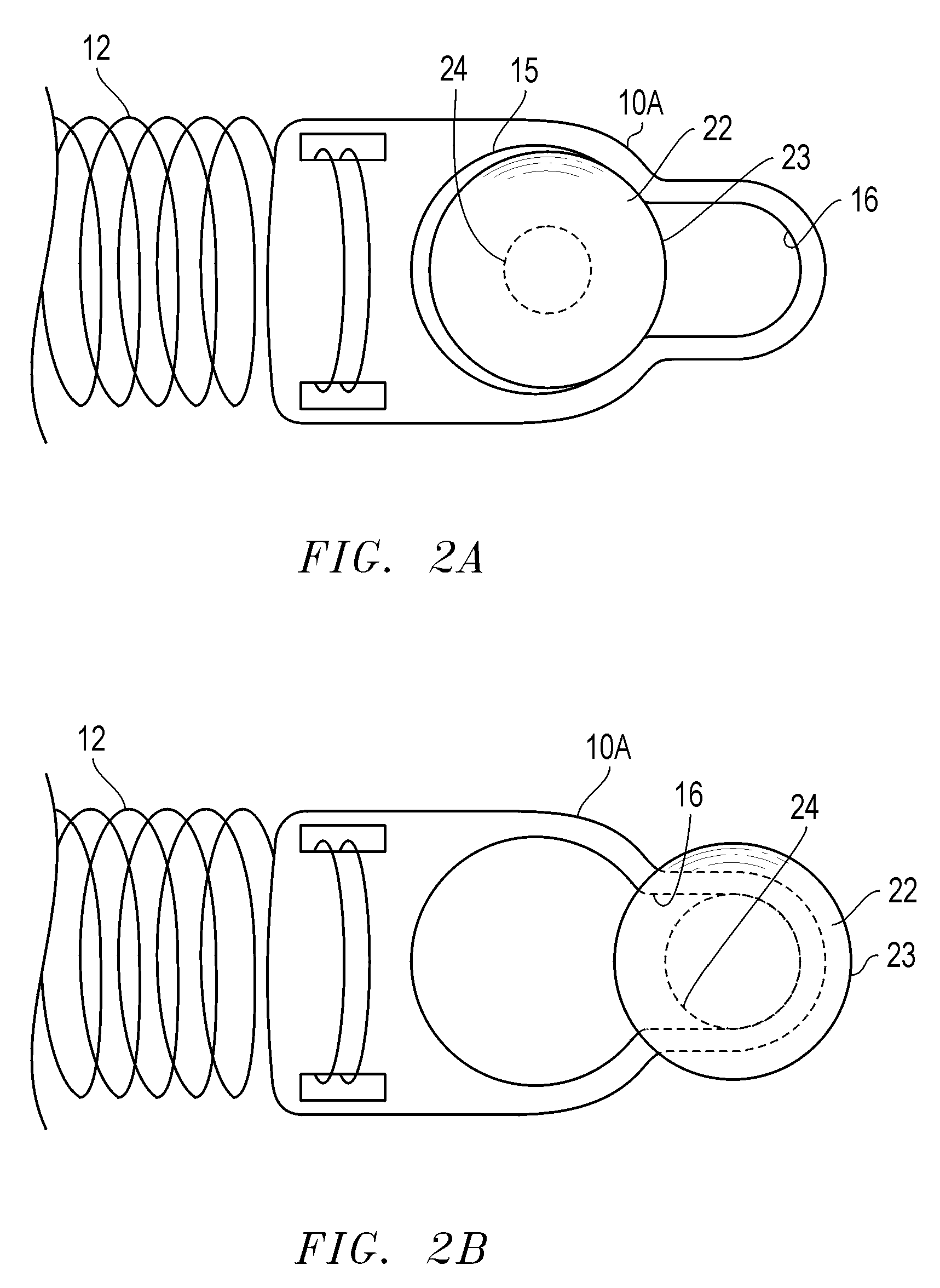 Orthodontic closed coil spring assembly and method of use thereof