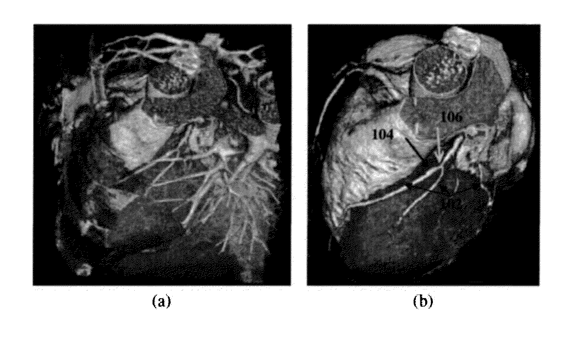 Method and System for Heart Isolation in Cardiac Computed Tomography Volumes for Patients with Coronary Artery Bypasses