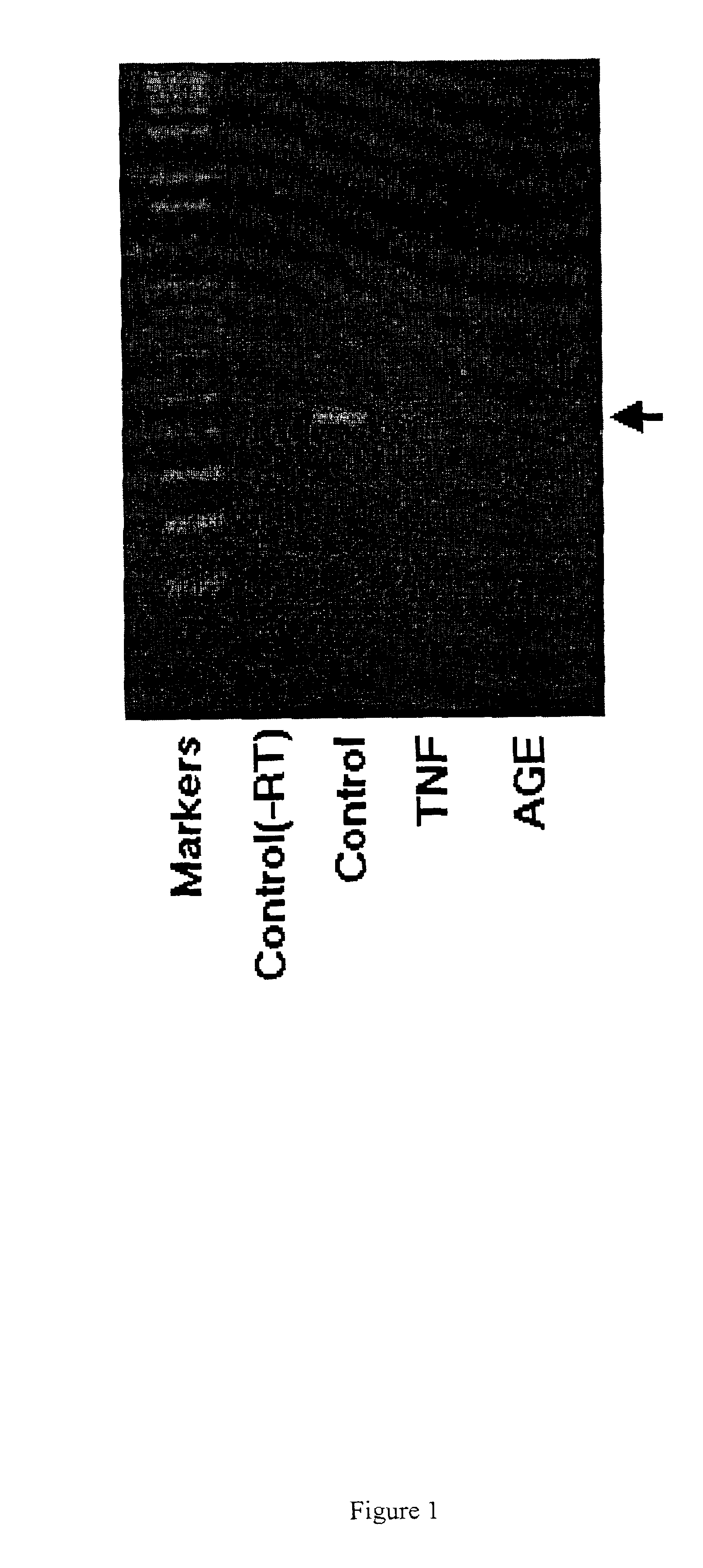 Methods and compositions for the treatment of inflammatory diseases