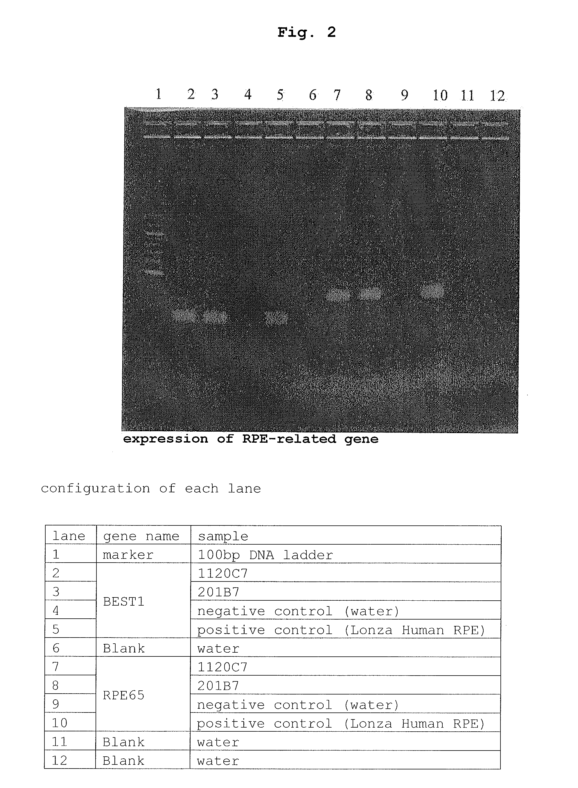 Method of producing retinal pigment epithelial cell