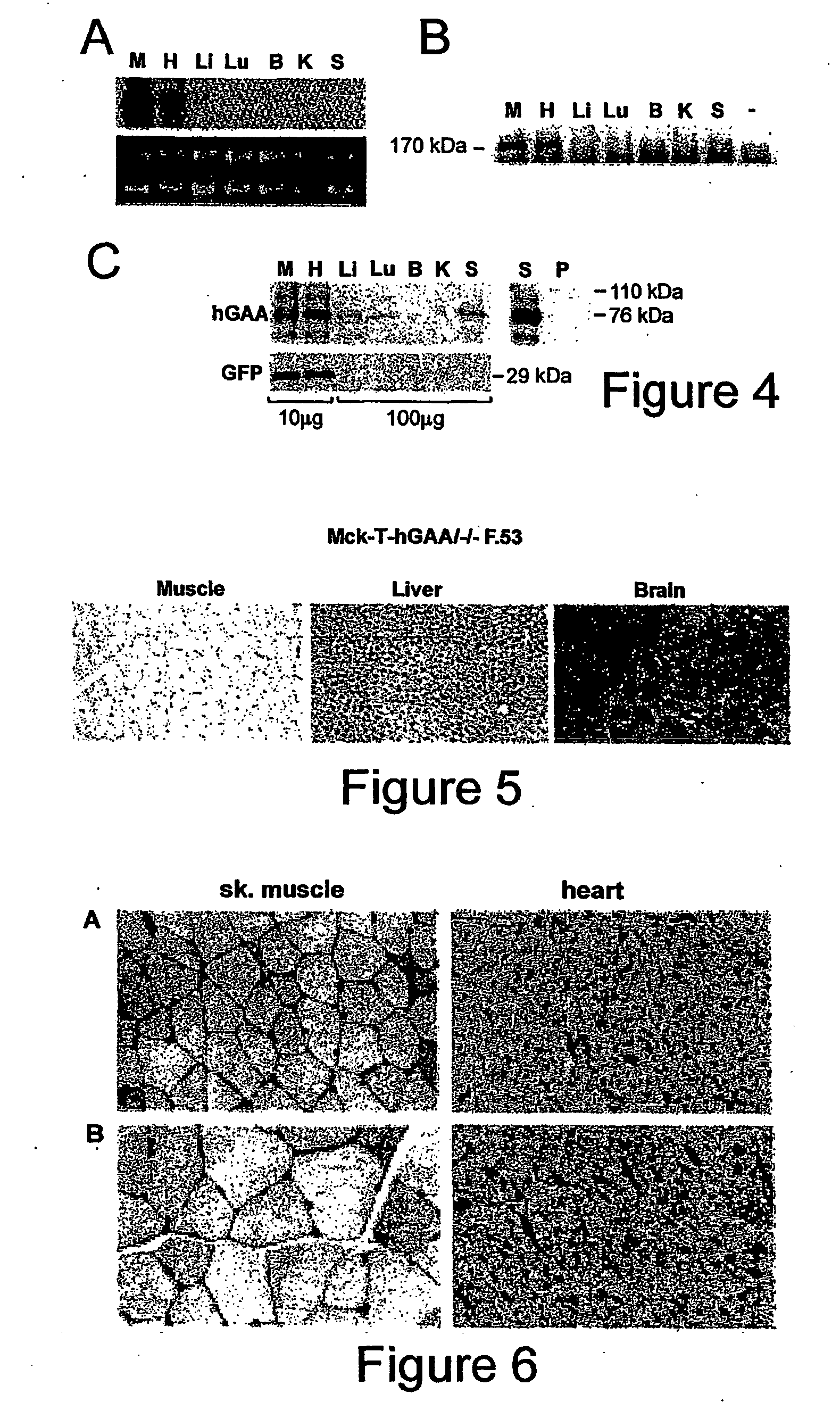 Synthesis and secretion of native recombinant lysosomal enzymes by liver