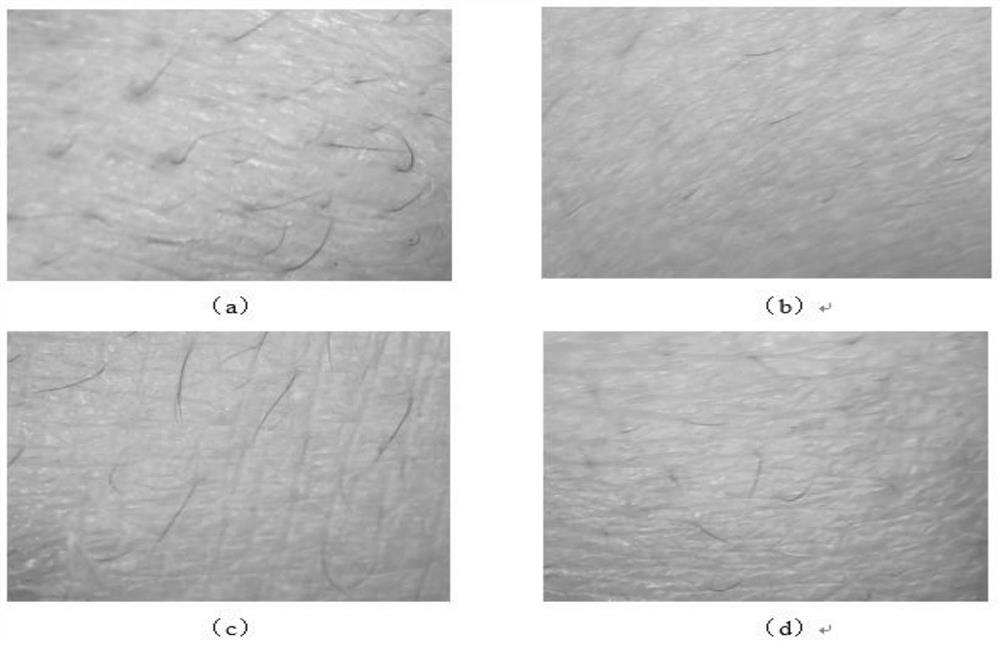 A Calculation Method of Human Facial Skin Moisture and Elasticity Index Based on Digital Image Processing Technology