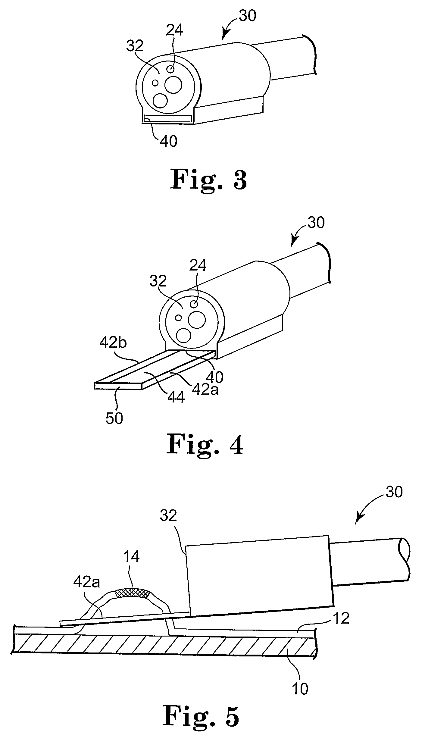 Apparatus and methods for internal surgical procedures