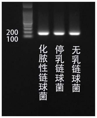 Reagent kit for detecting streptococcus pyogenes