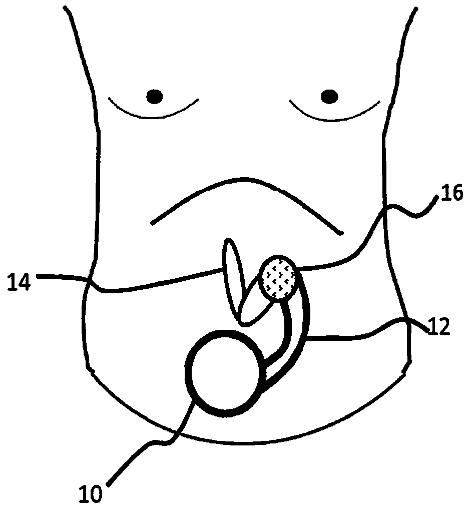 Fetal position monitoring system and method