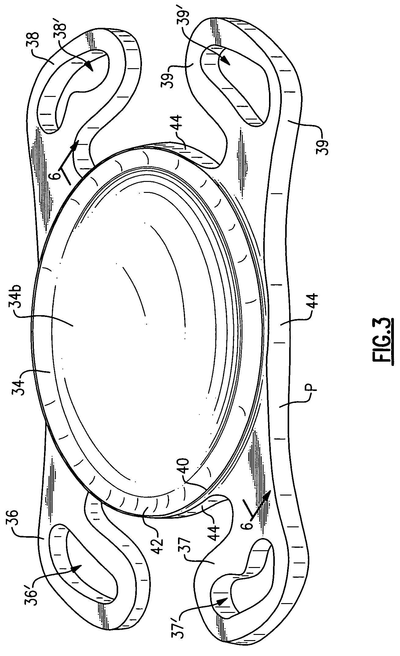 Small incision intraocular lens with anti-PCO feature