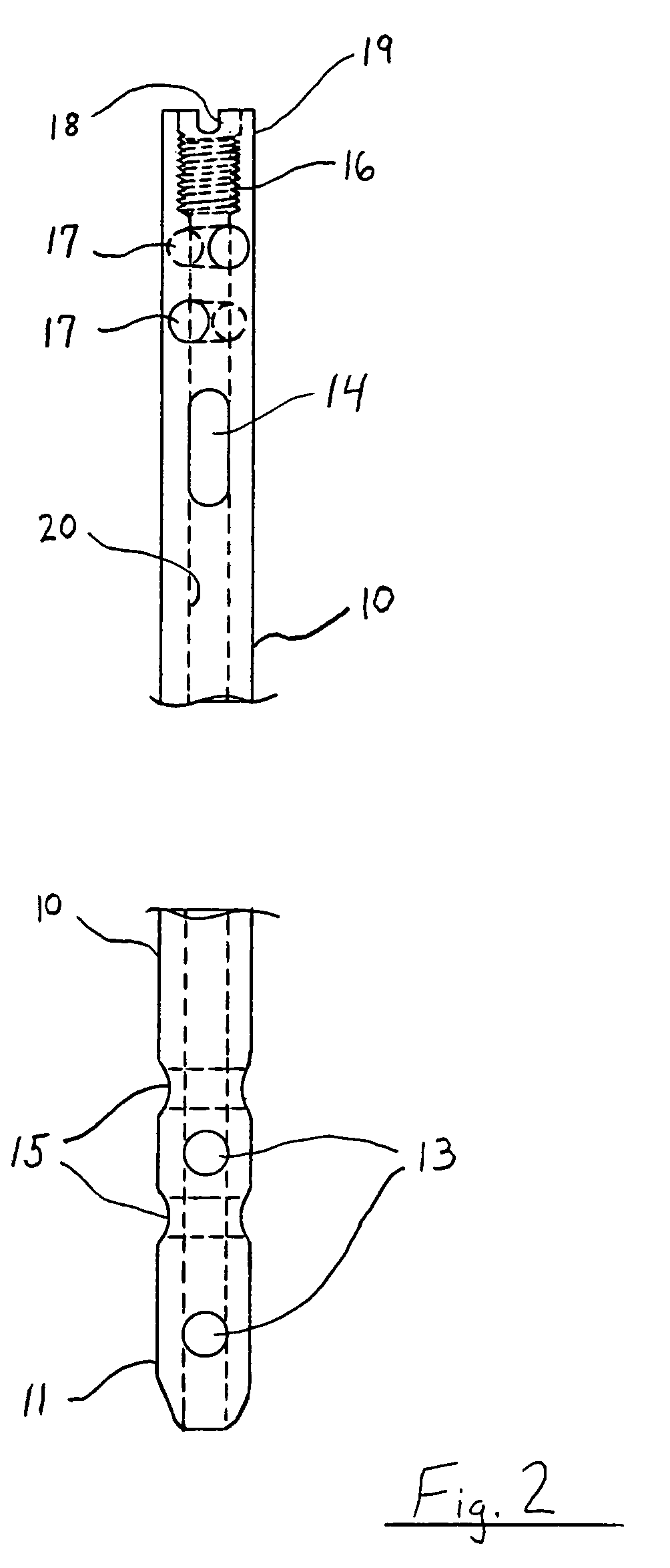 Method and system for securing an intramedullary nail