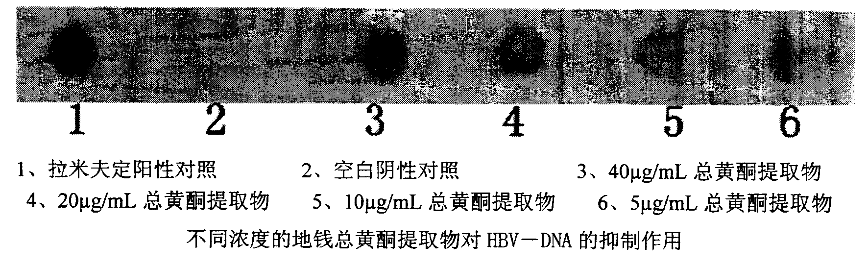 Technique for preparing liverwort extract and application of it in preparing medicine for treating liver cancer and hepatitis B