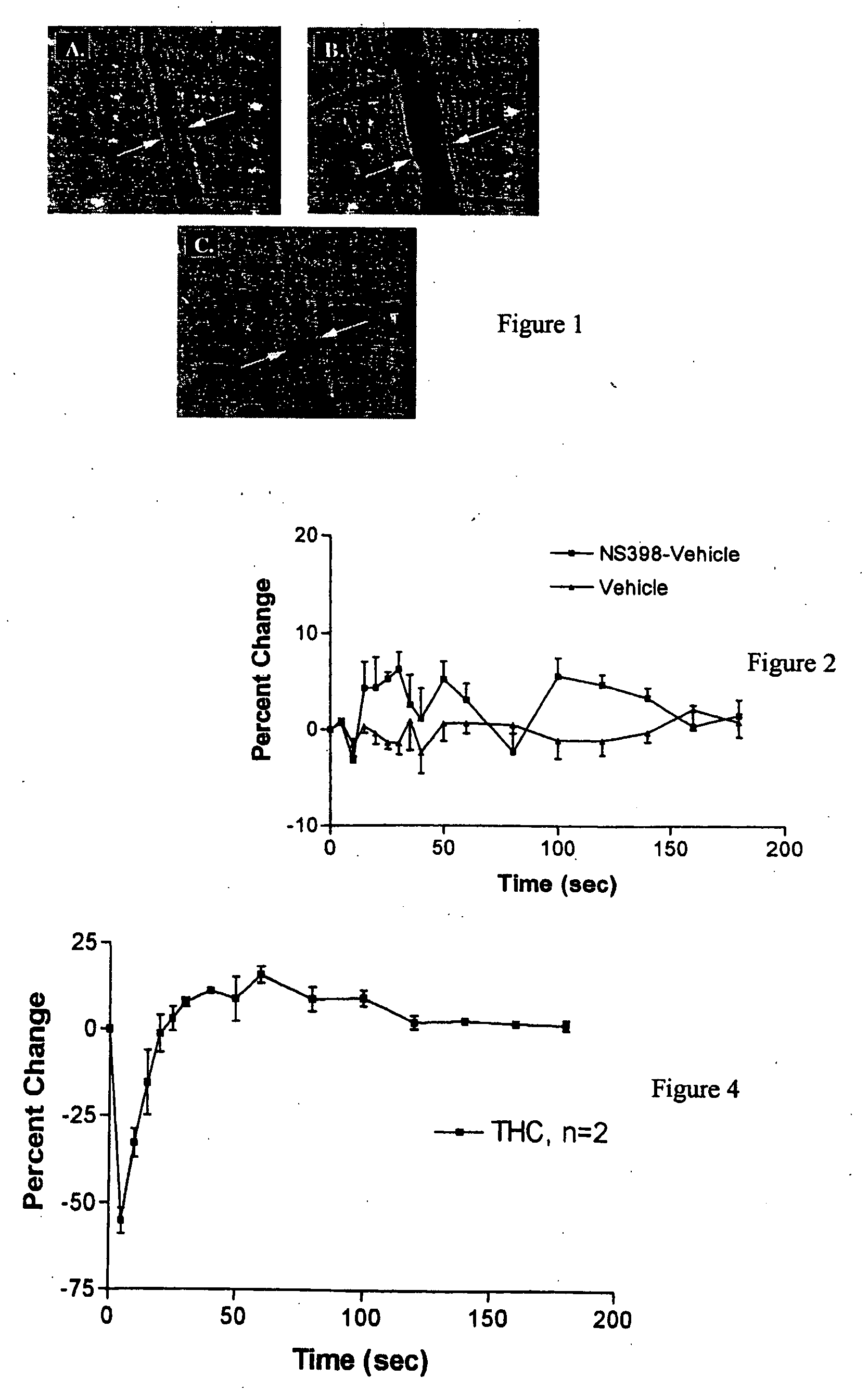 Method and kit for regulation of microvascular tone