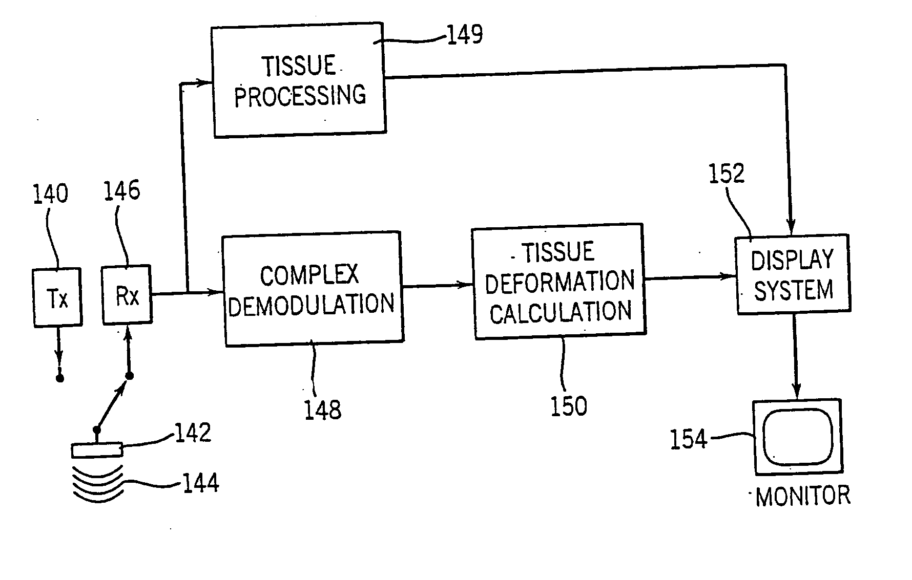 Method and apparatus for providing real-time calculation and display of tissue deformation in ultrasound imaging