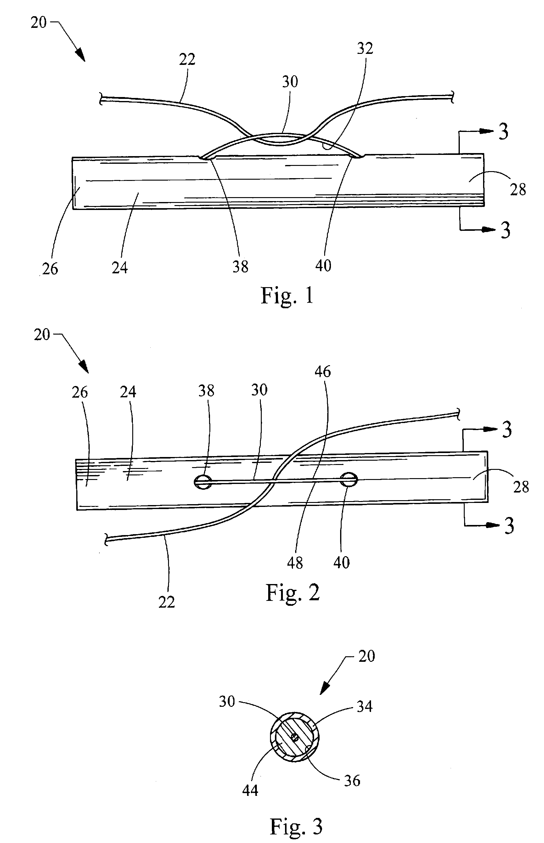 Visceral anchors for purse-string closure of perforations