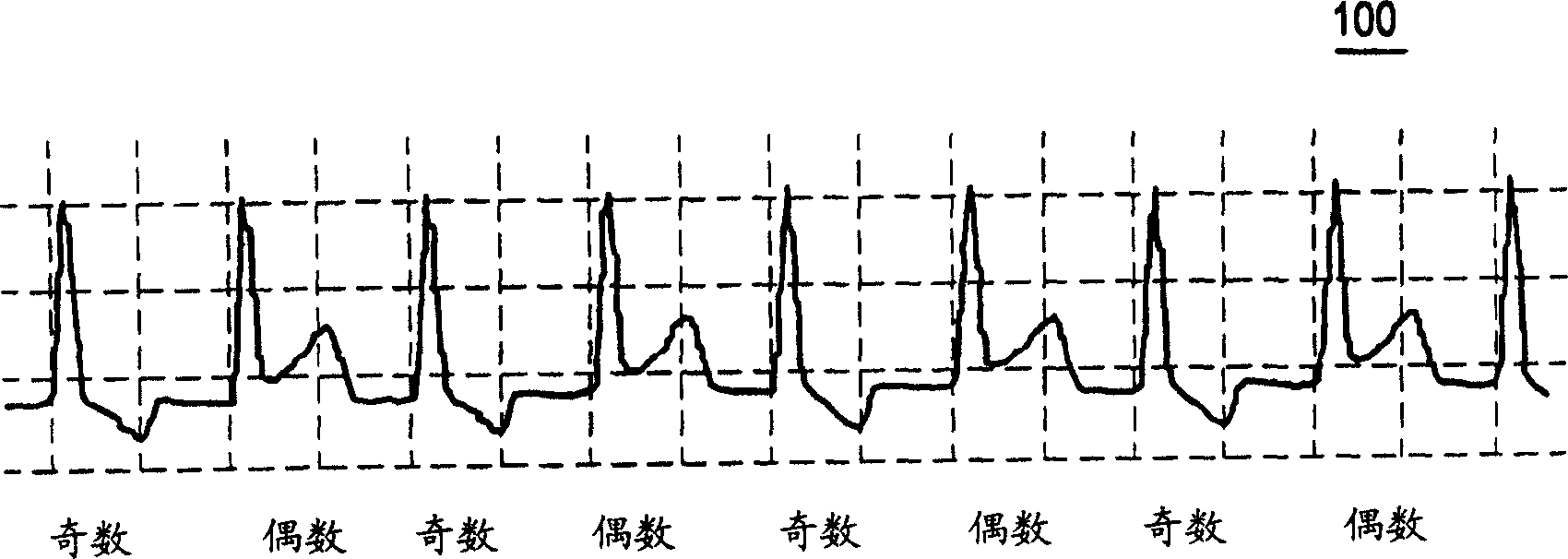 Method and system for improved measurement of t-wave alternans