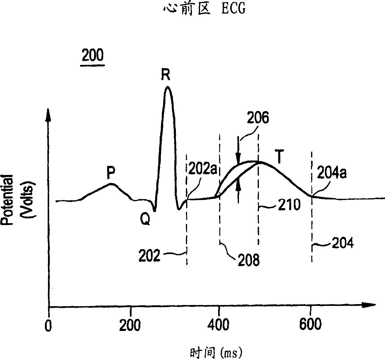 Method and system for improved measurement of t-wave alternans