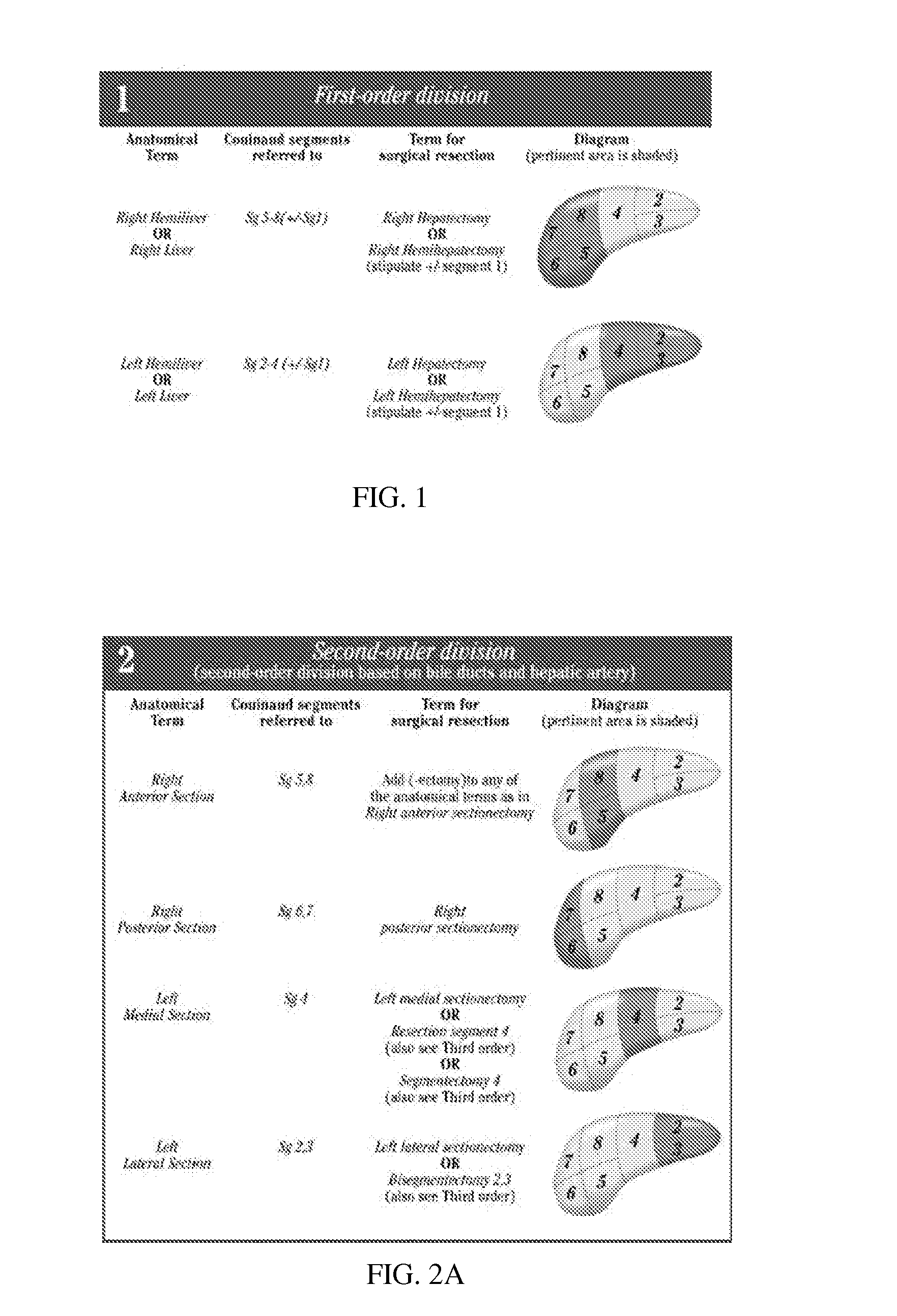 CT atlas of the brisbane 2000 system of liver anatomy for radiation oncologists