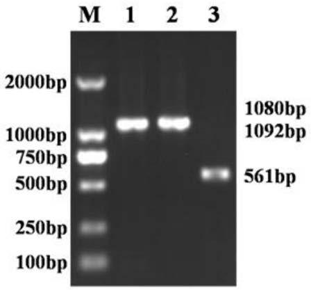 Construction method of SAG2 gene, ROP9 gene and MIC3 gene recombinant adenovirus, recombinant adenovirus and application