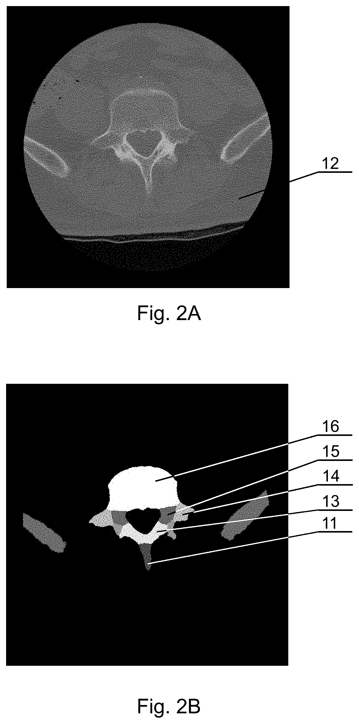 Autonomous segmentation of three-dimensional nervous system structures from medical images