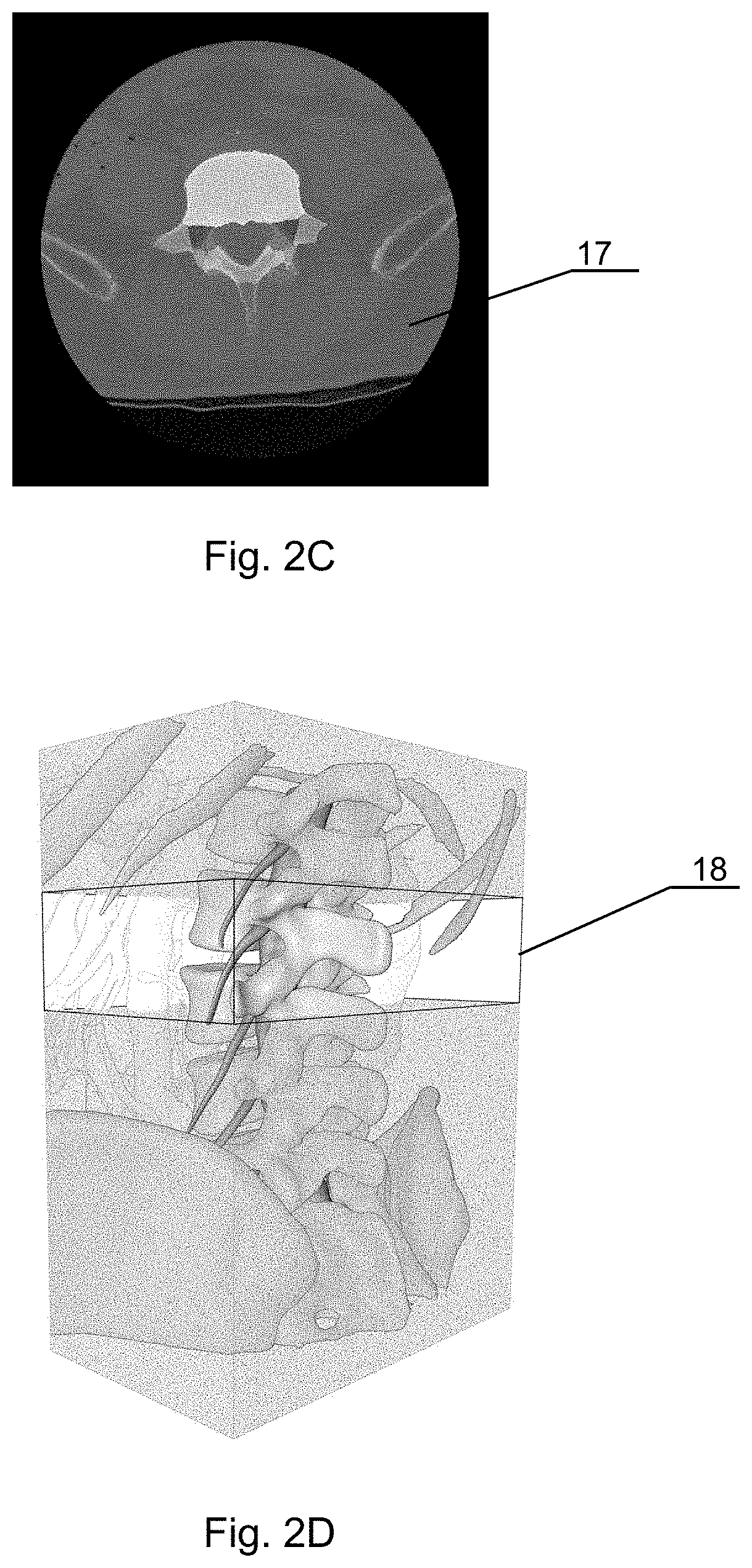 Autonomous segmentation of three-dimensional nervous system structures from medical images