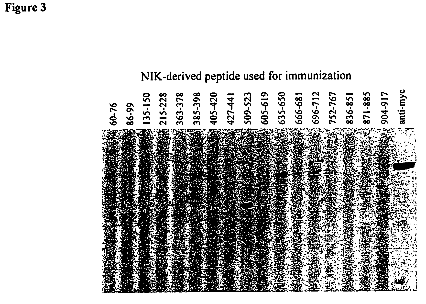 Anti-NIK antibodies and uses thereof