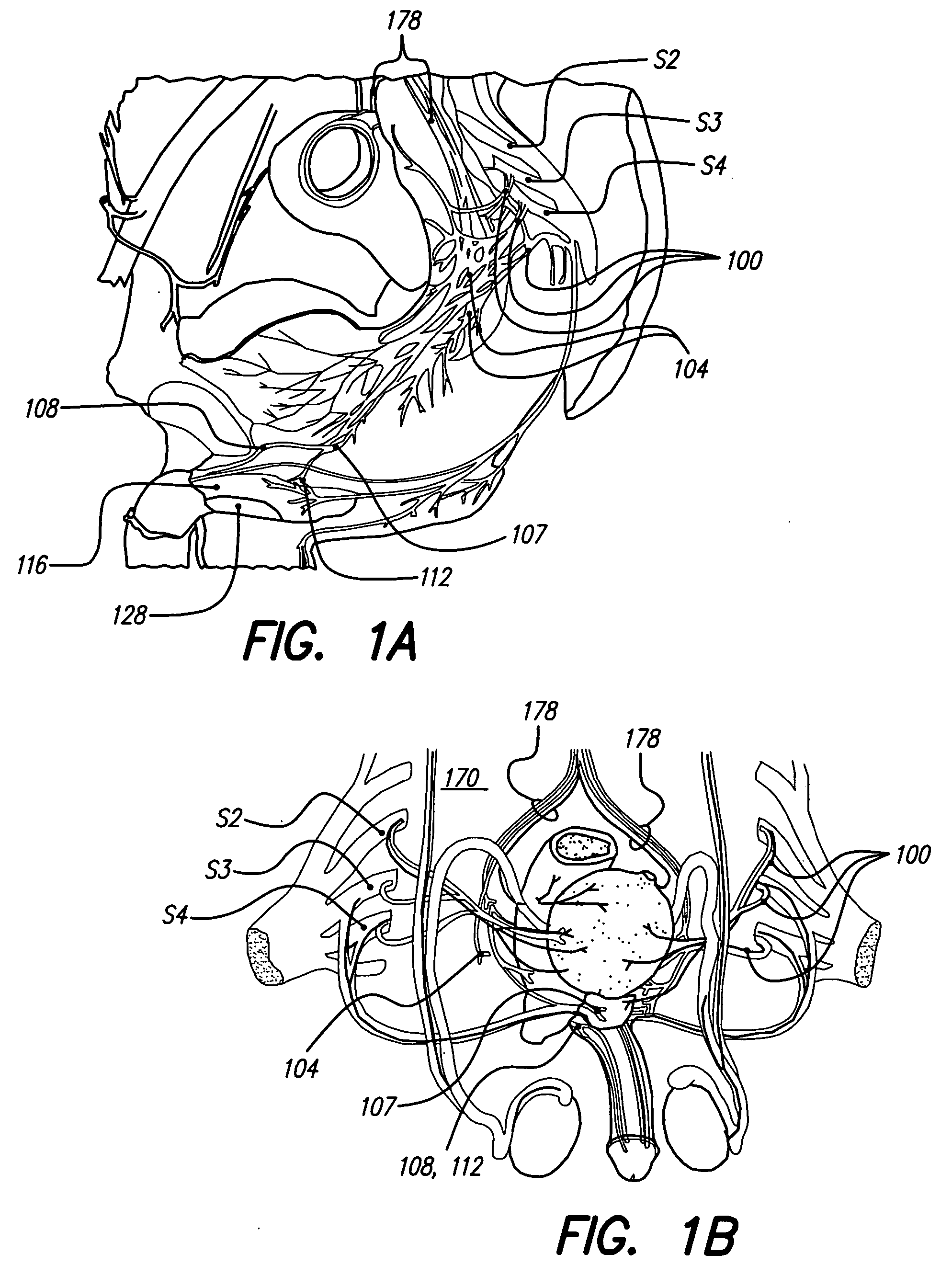 Methods and systems for stimulation as a therapy for erectile dysfunction