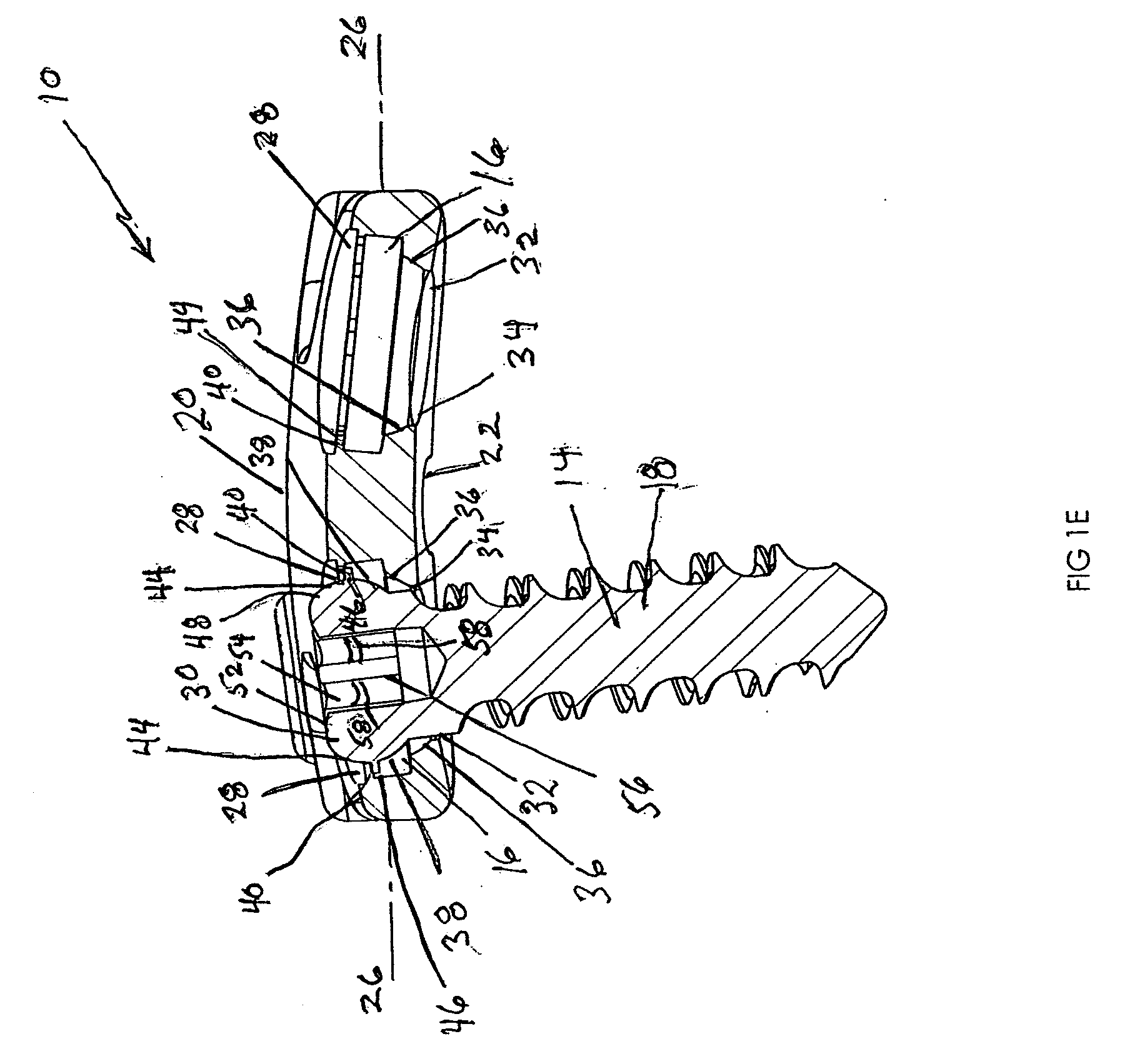 Anterior vertebral plate with quick lock screw