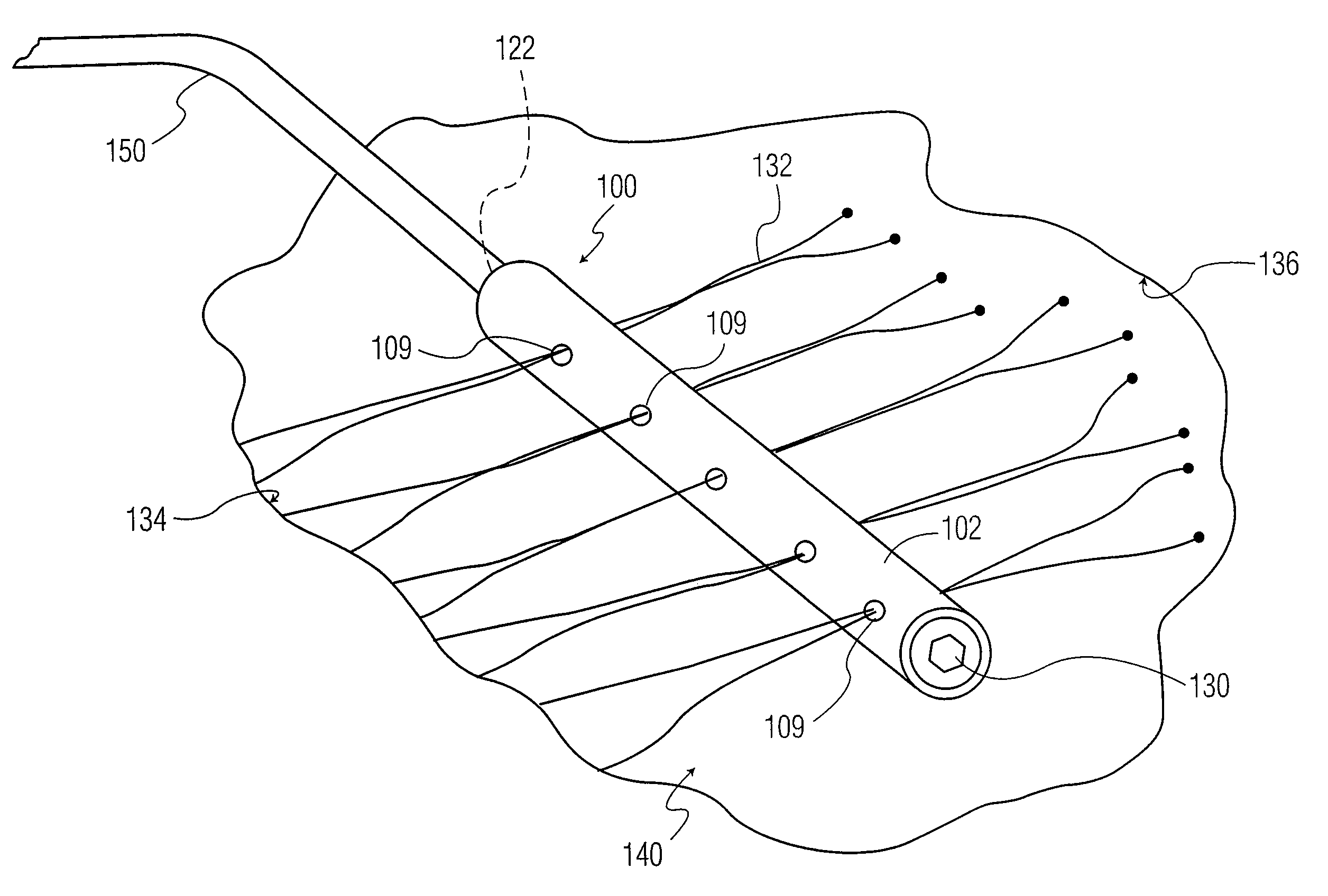 Method for treating a wound