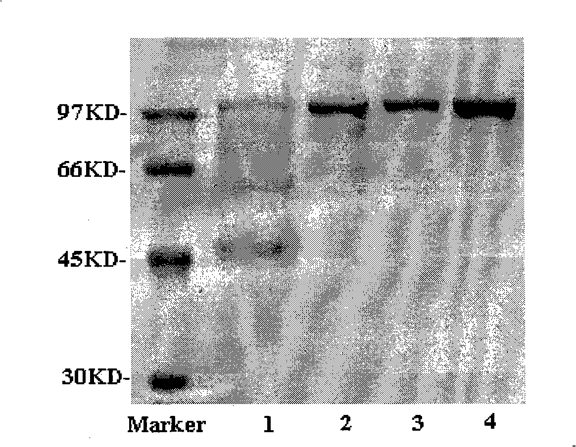 Fusion protein, encoding gene and uses thereof