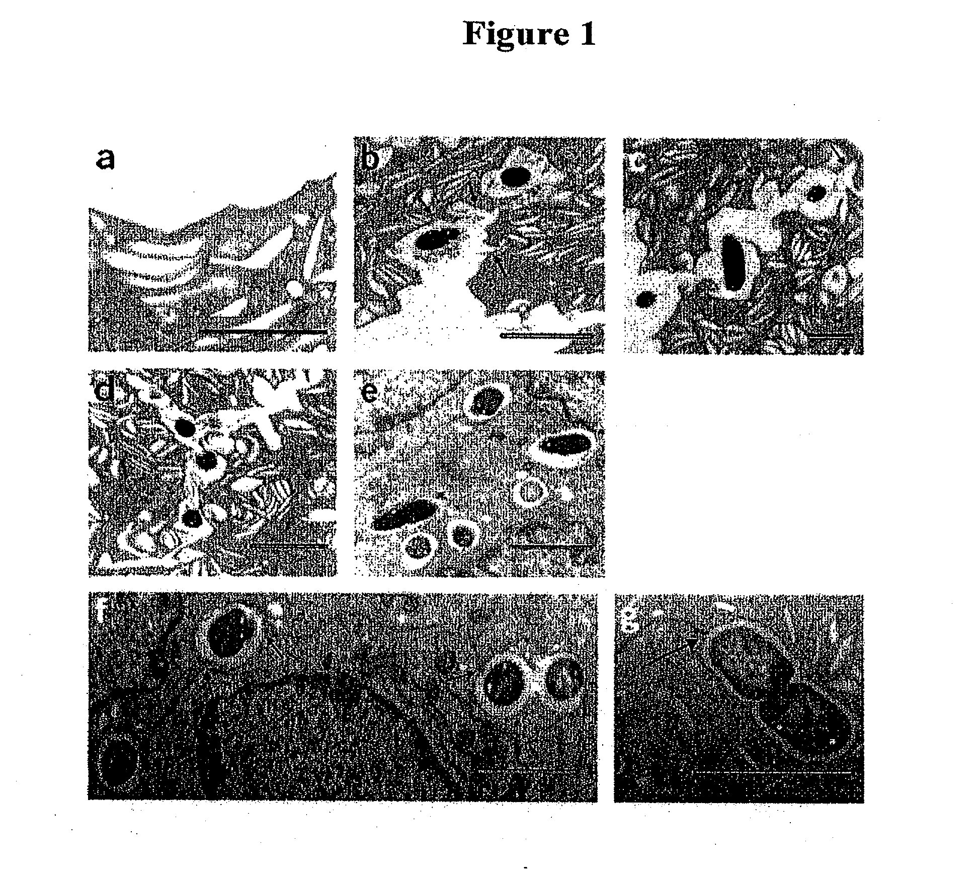 Methods and compositions for treating urinary tract infections using agents that mimic or elevate cyclic amp