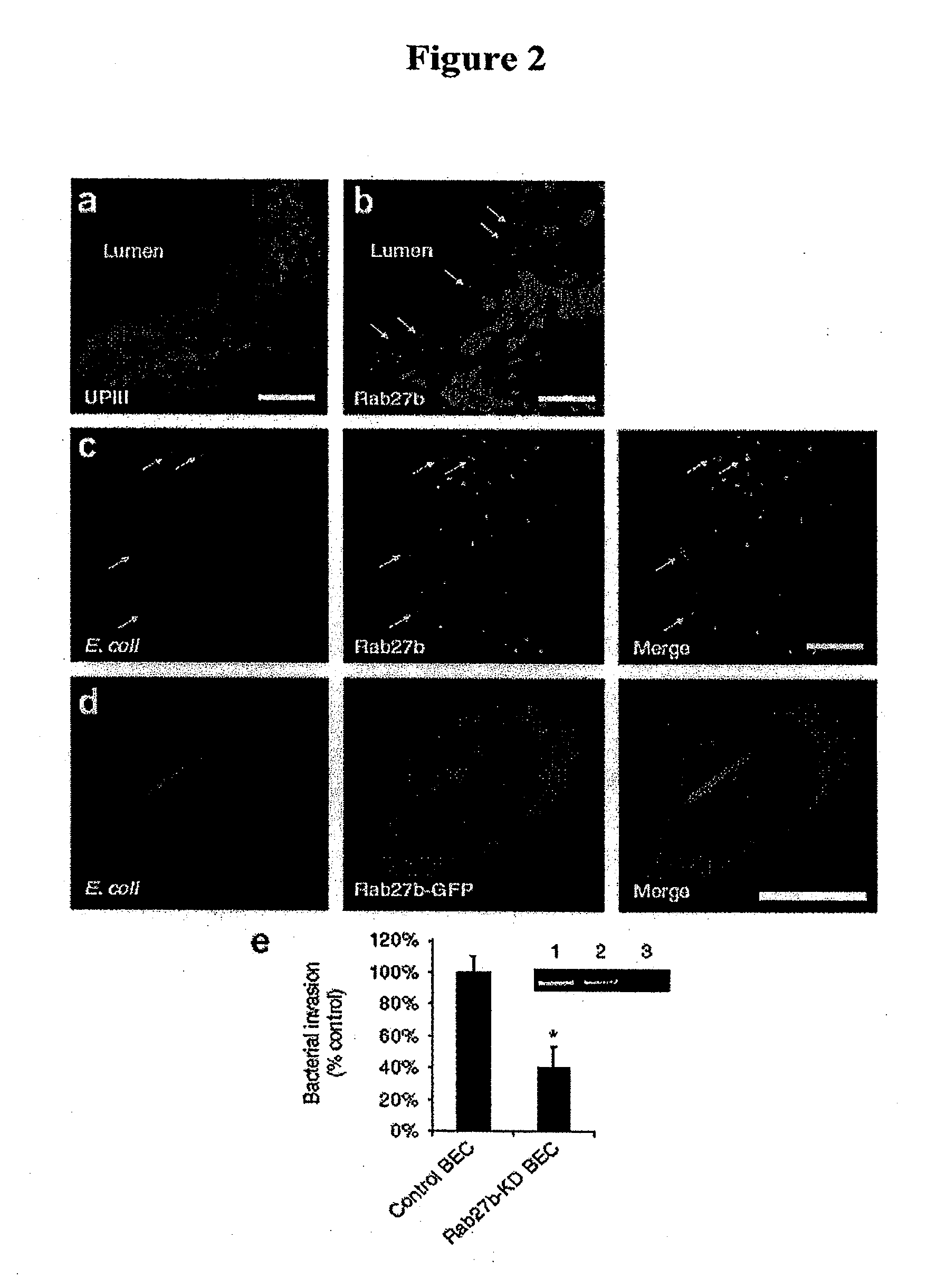 Methods and compositions for treating urinary tract infections using agents that mimic or elevate cyclic amp