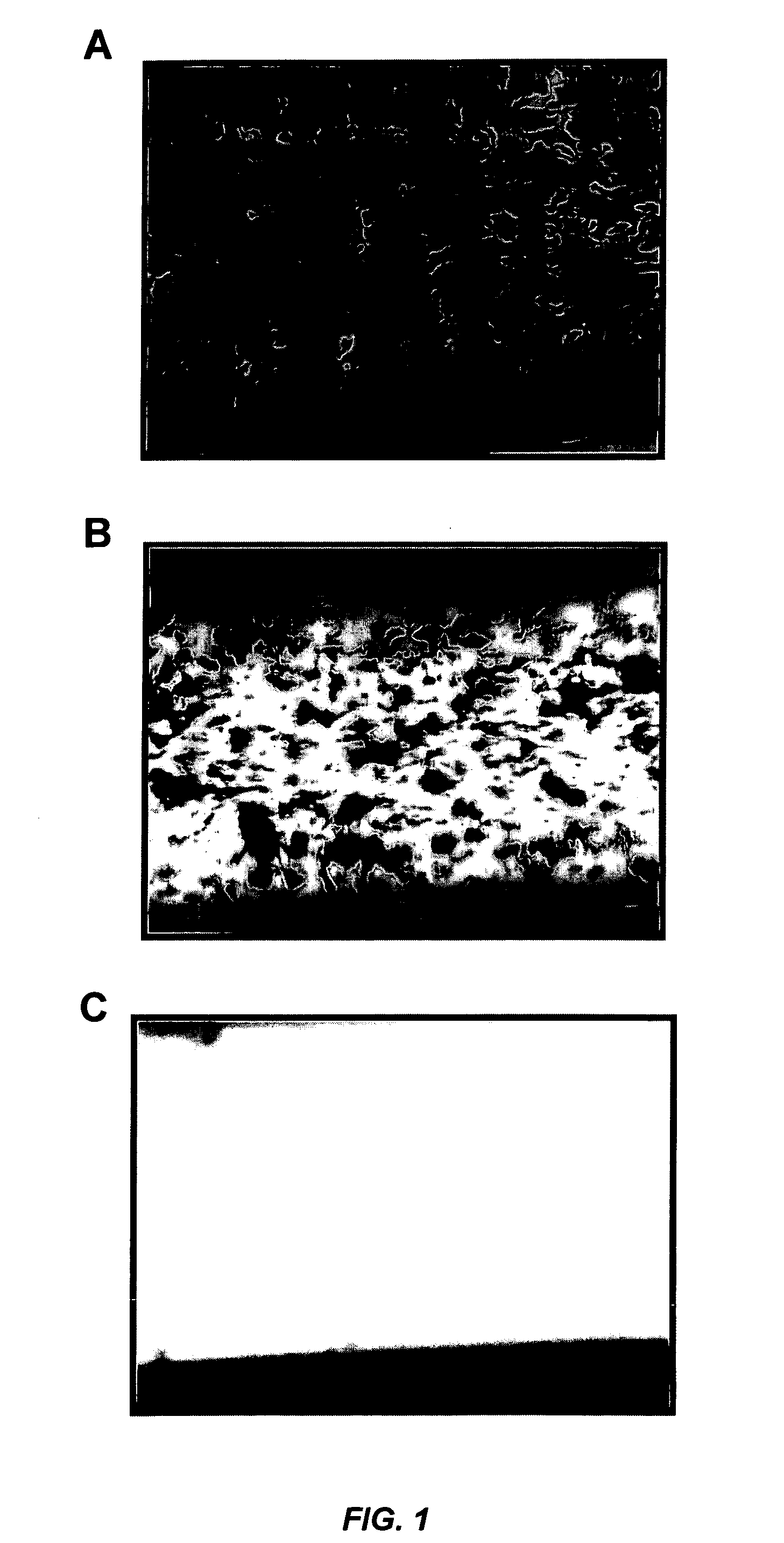 Methods of treatment with Syk inhibitors