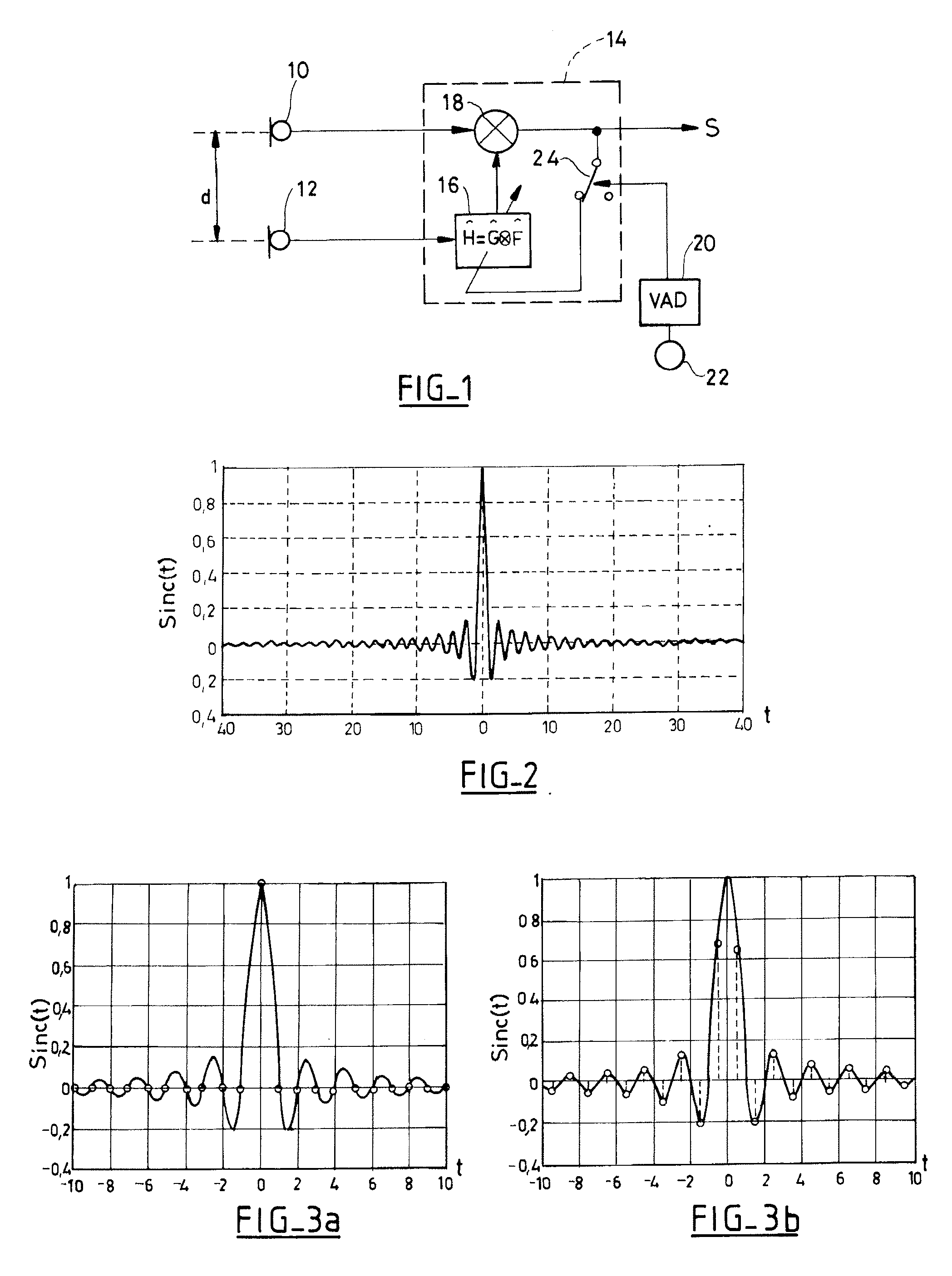 Audio equipment including means for de-noising a speech signal by fractional delay filtering, in particular for a "hands-free" telephony system