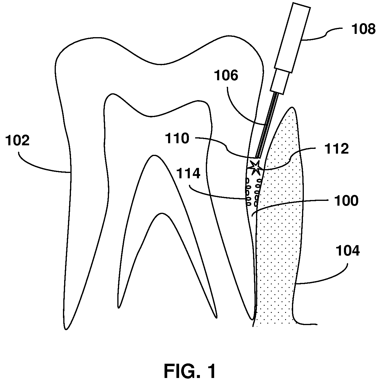 Medical laser apparatus with enhanced disinfection function