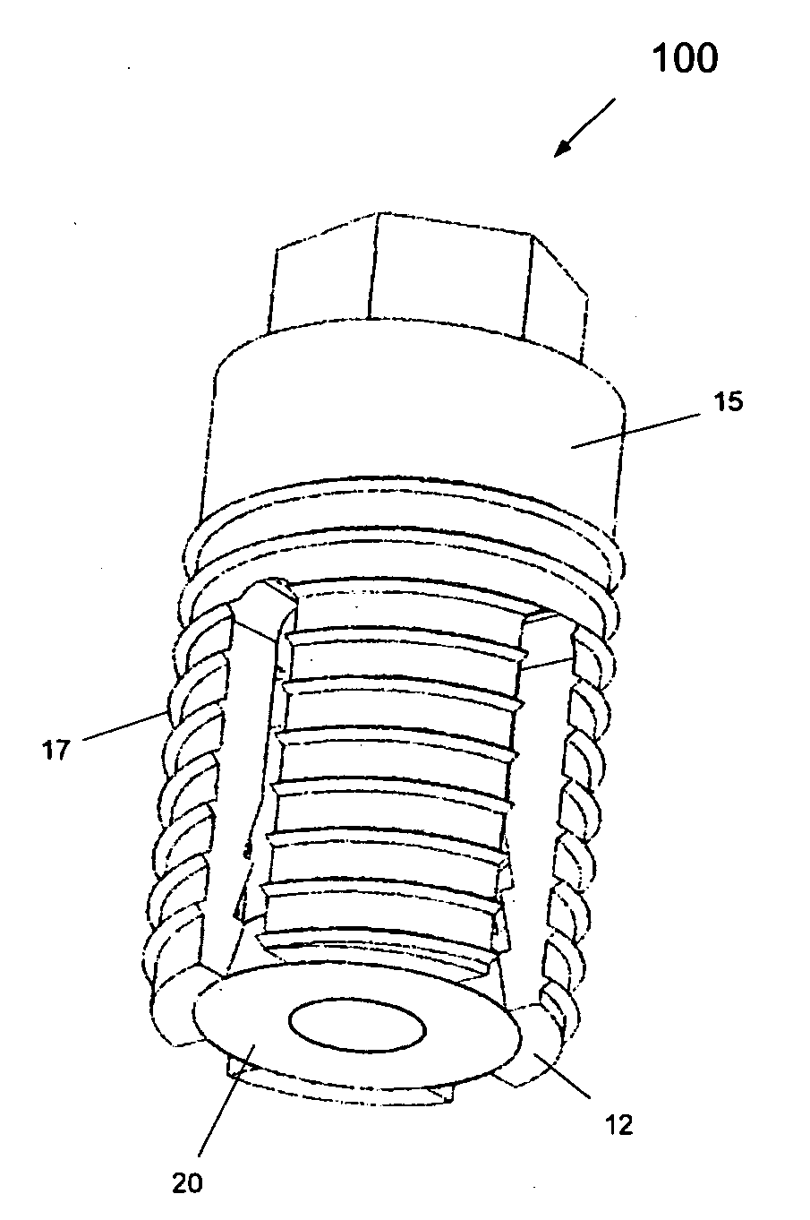 Expandable dental implants of high surface area and methods of expanding the same