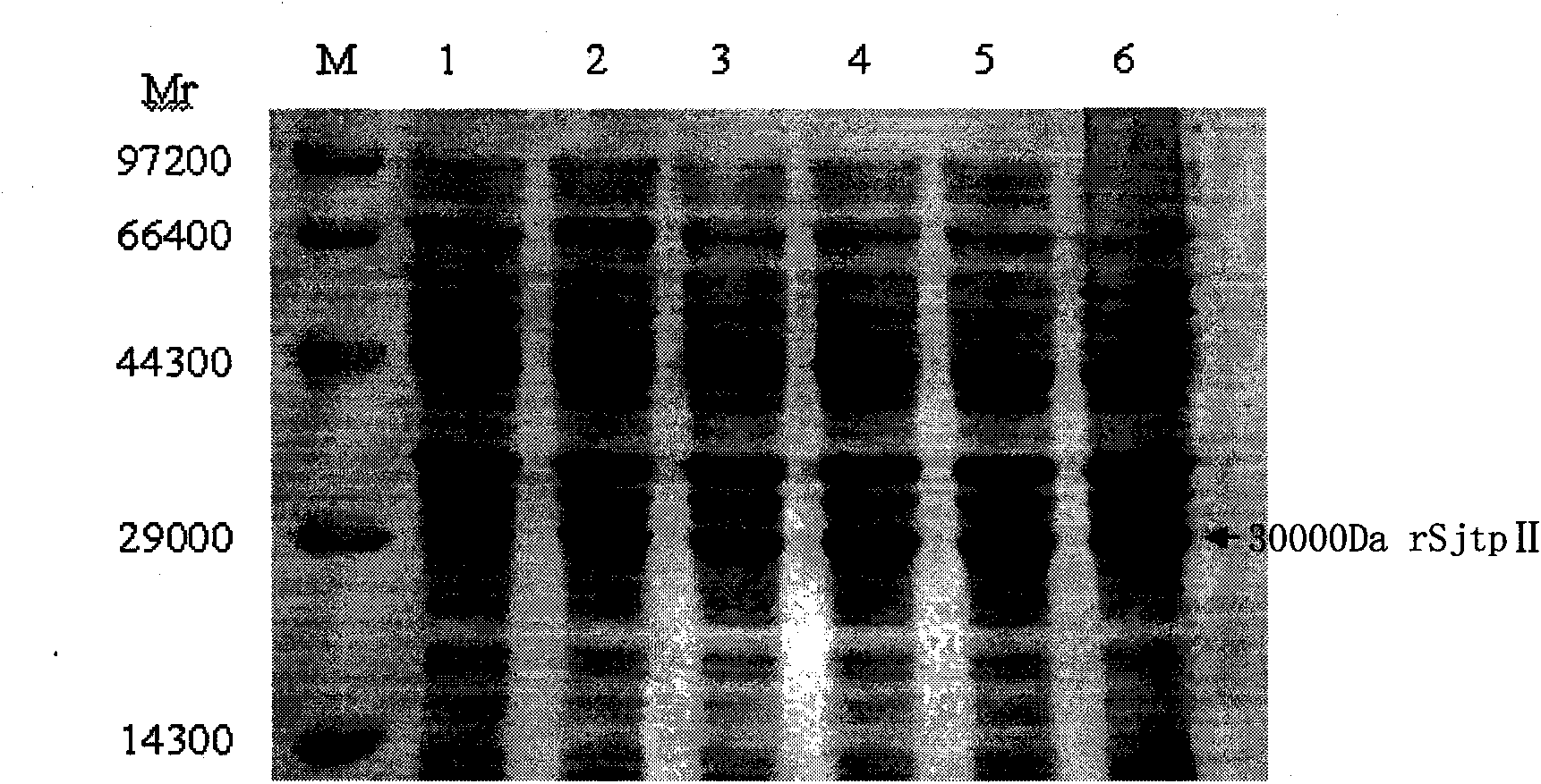 Recombinant expression carrier containing schistosoma japonicum gene and application thereof