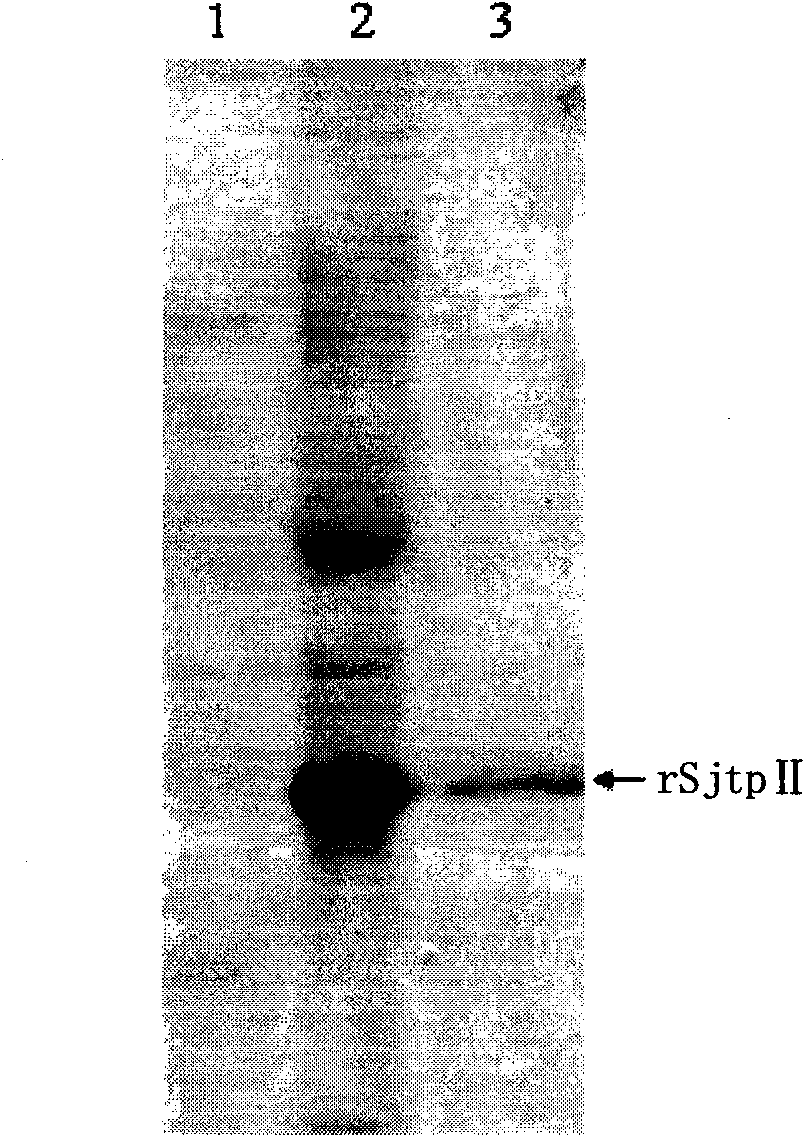 Recombinant expression carrier containing schistosoma japonicum gene and application thereof