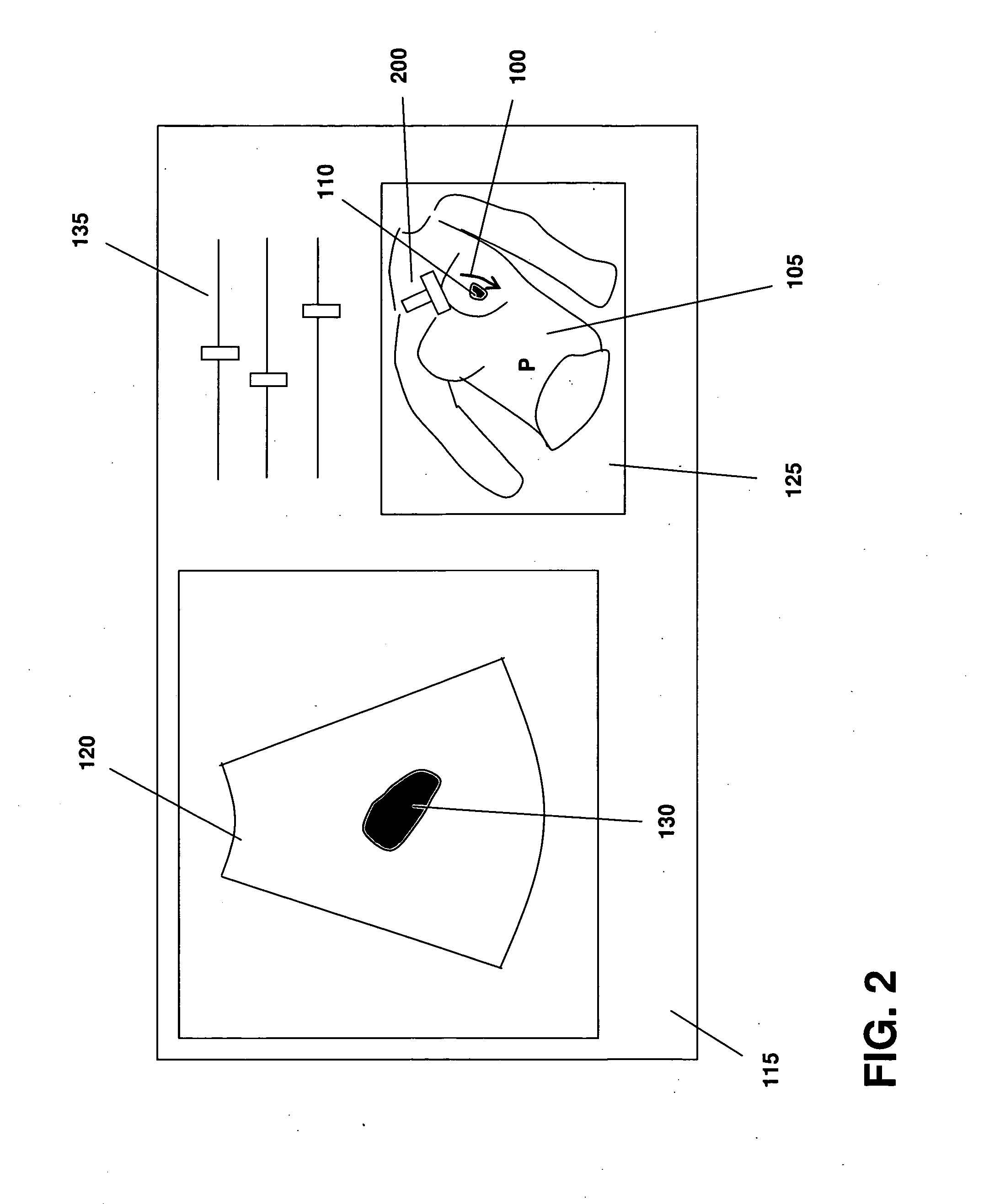 Methods and systems for guiding the acquisition of ultrasound images