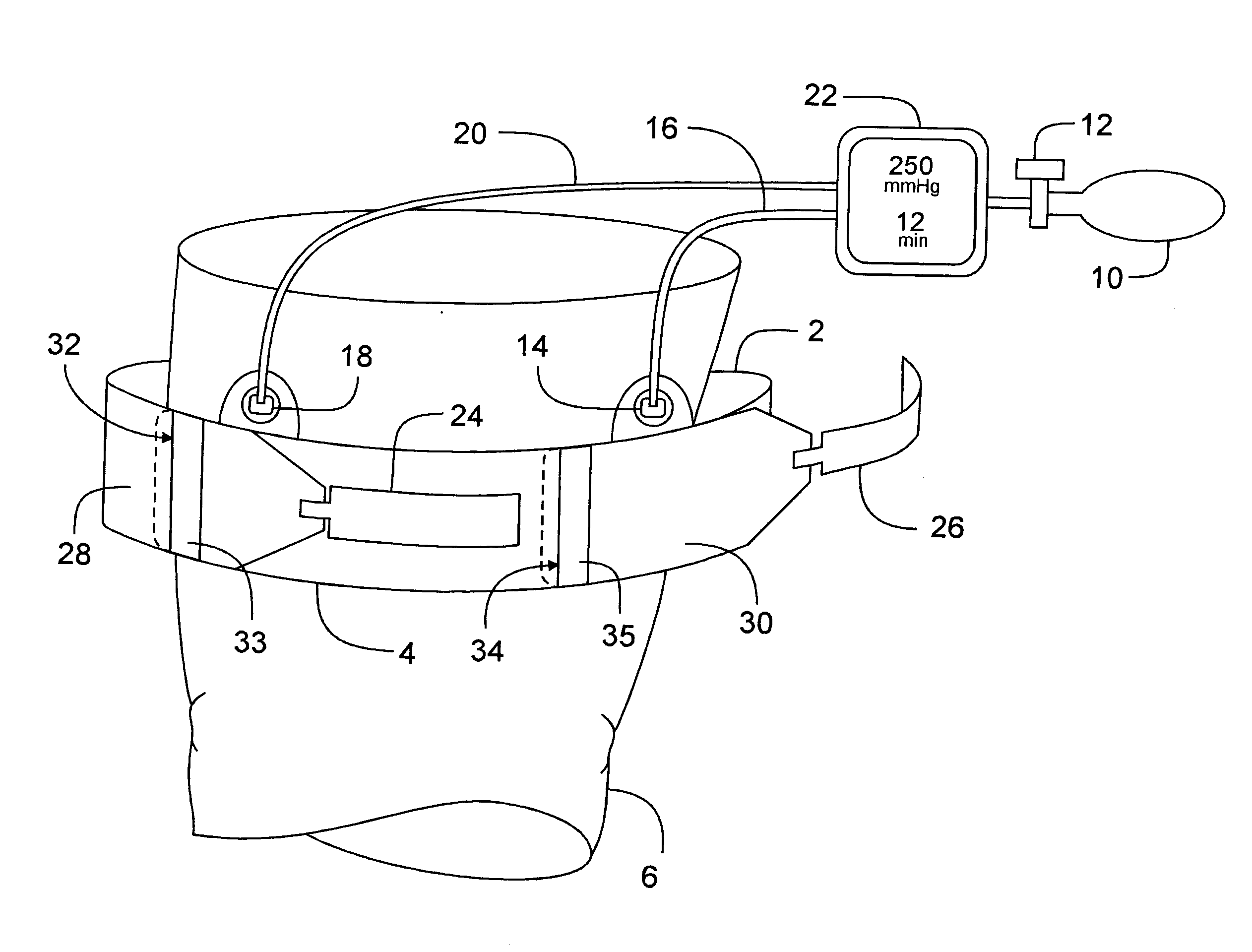 Extendible Tourniquet Cuff with Stabilizer for Improved Utility and Safety