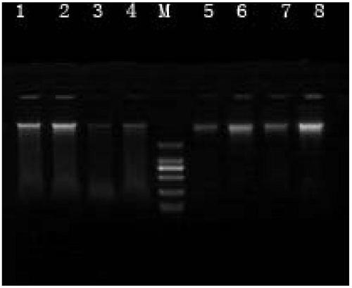 Genome DNA (Deoxyribonucleic Acid) preservation solution of saliva and oral cavity swab