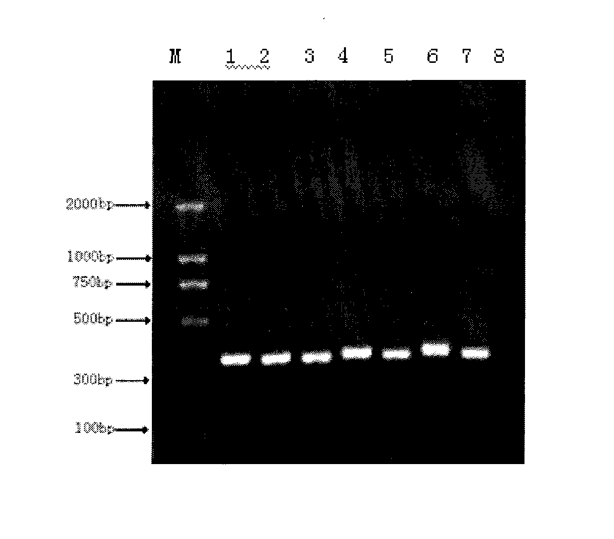 Rapid detection method of blood pathogenic bacteria based on CE-SSCP (Capillary Electrophoresis-Single Strand Conformation Polymorphism)