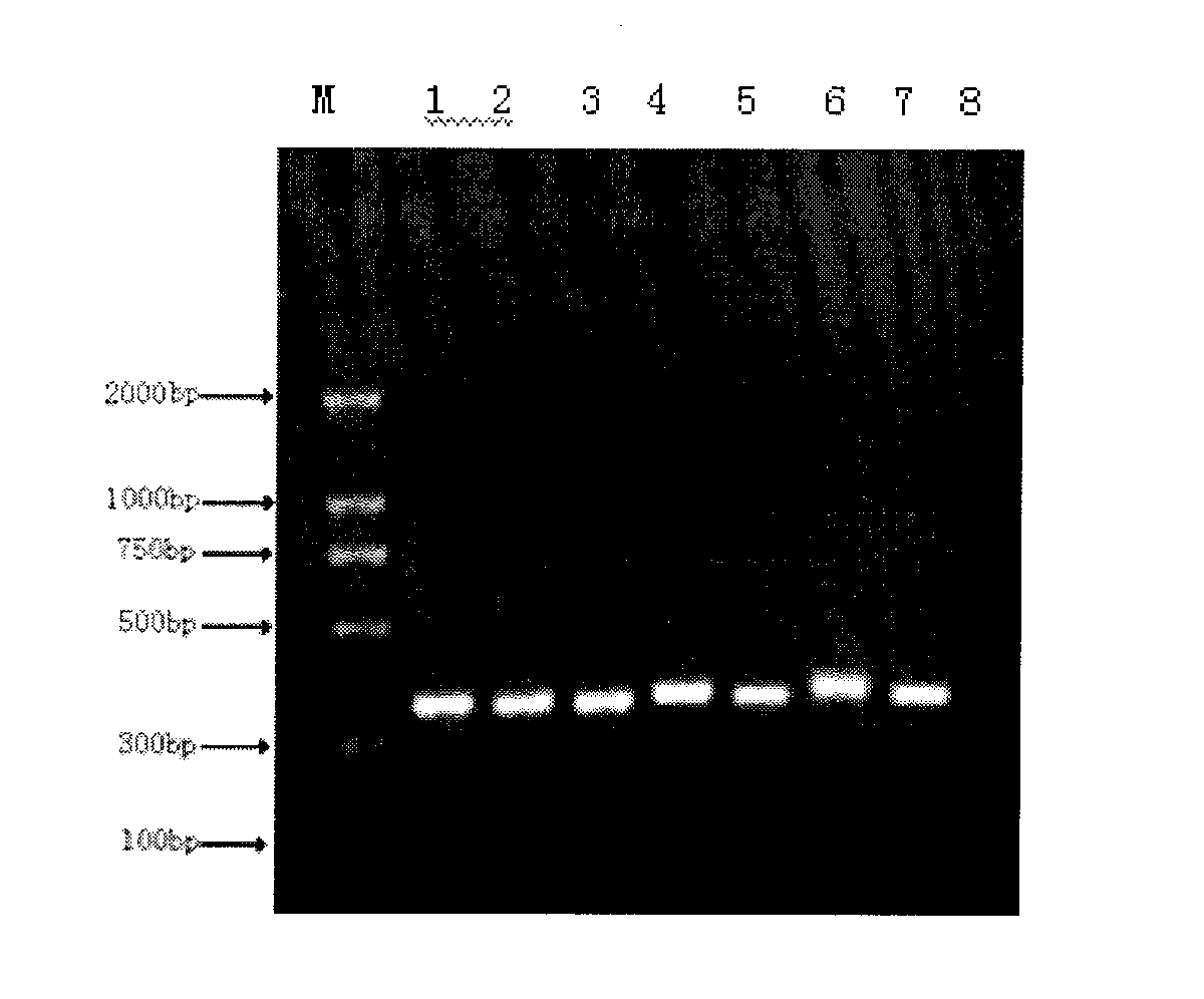 Rapid detection method of blood pathogenic bacteria based on CE-SSCP (Capillary Electrophoresis-Single Strand Conformation Polymorphism)