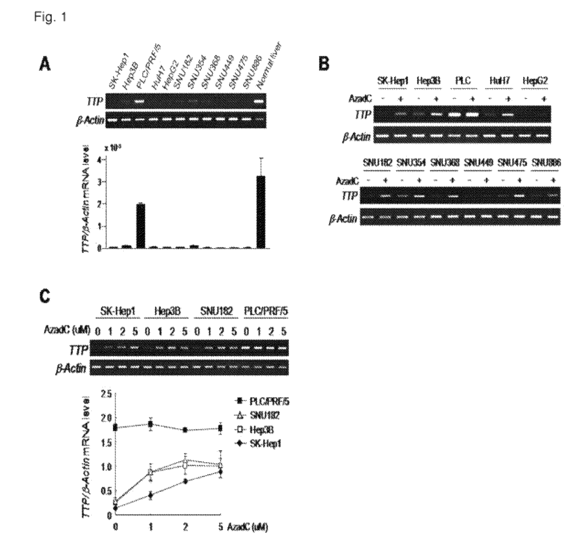 Method for diagnosis/prognosis of cancers using an epigenetic marker consisting of a specific single CpG site in TTP promoter and treatment of cancers by regulating its epigenetic status