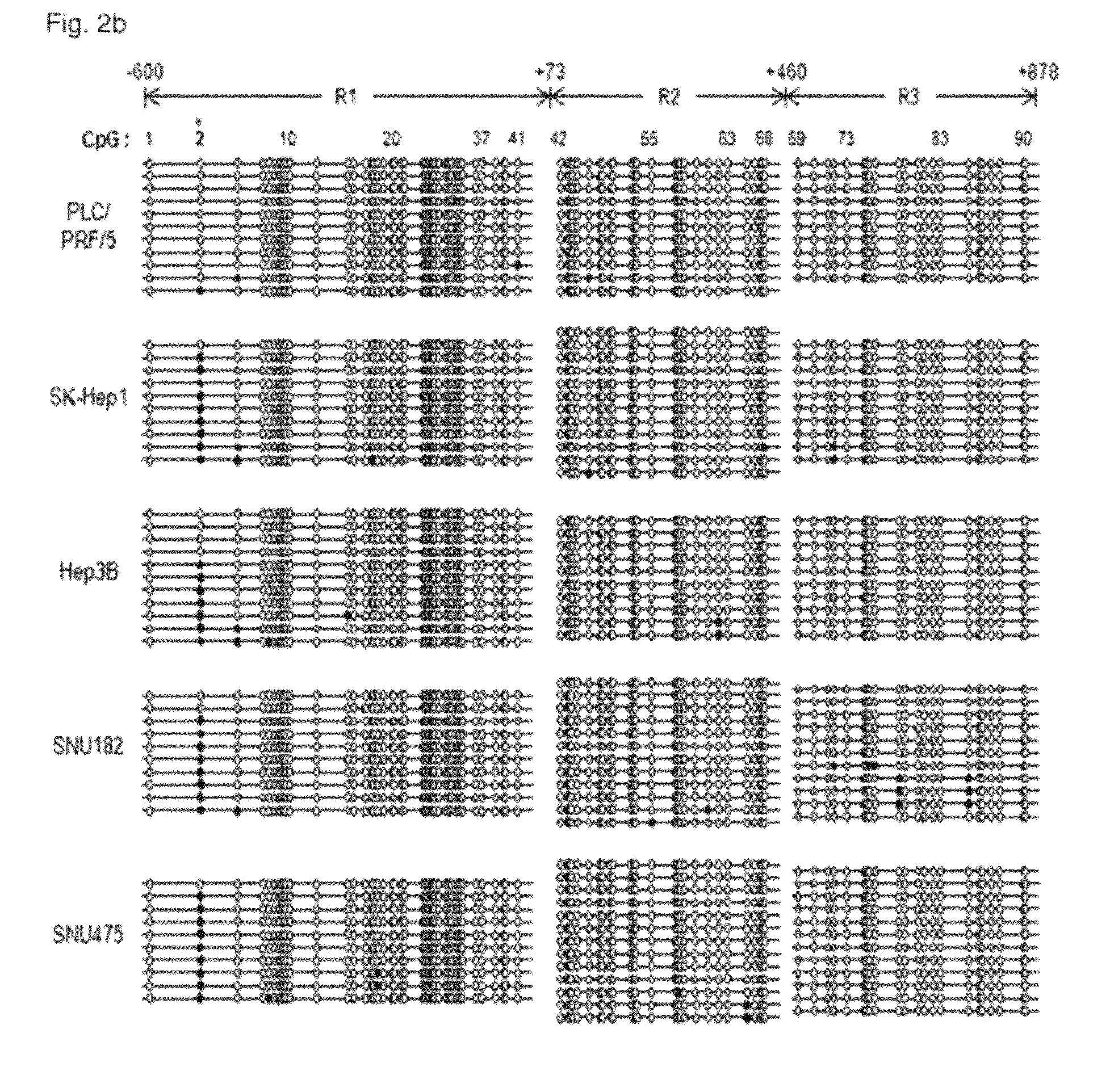 Method for diagnosis/prognosis of cancers using an epigenetic marker consisting of a specific single CpG site in TTP promoter and treatment of cancers by regulating its epigenetic status