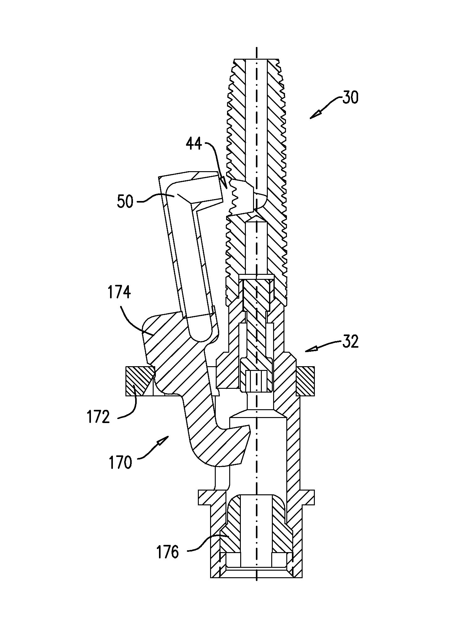 Implants, tools, and methods for sinus lift and lateral ridge augmentation
