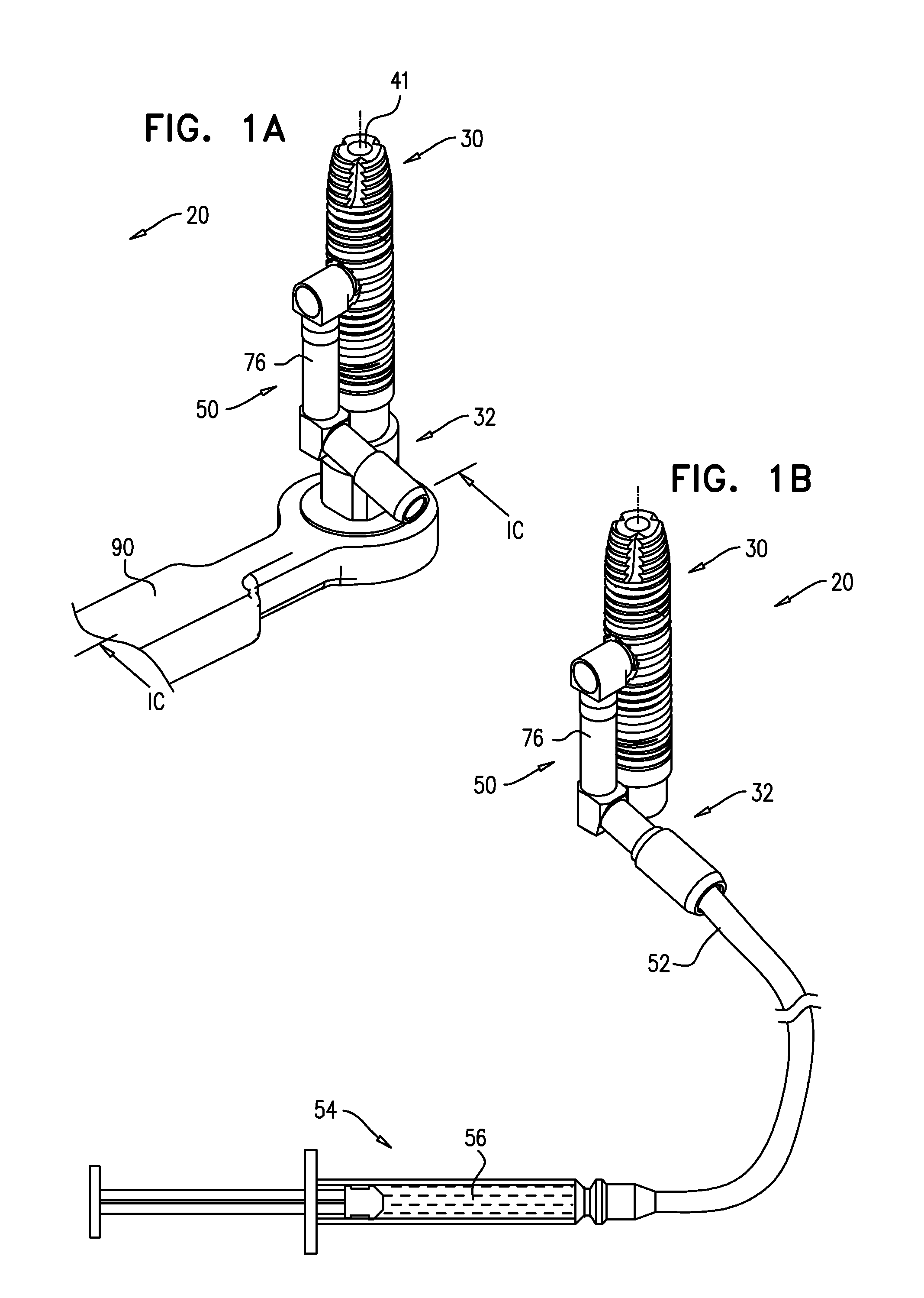 Implants, tools, and methods for sinus lift and lateral ridge augmentation