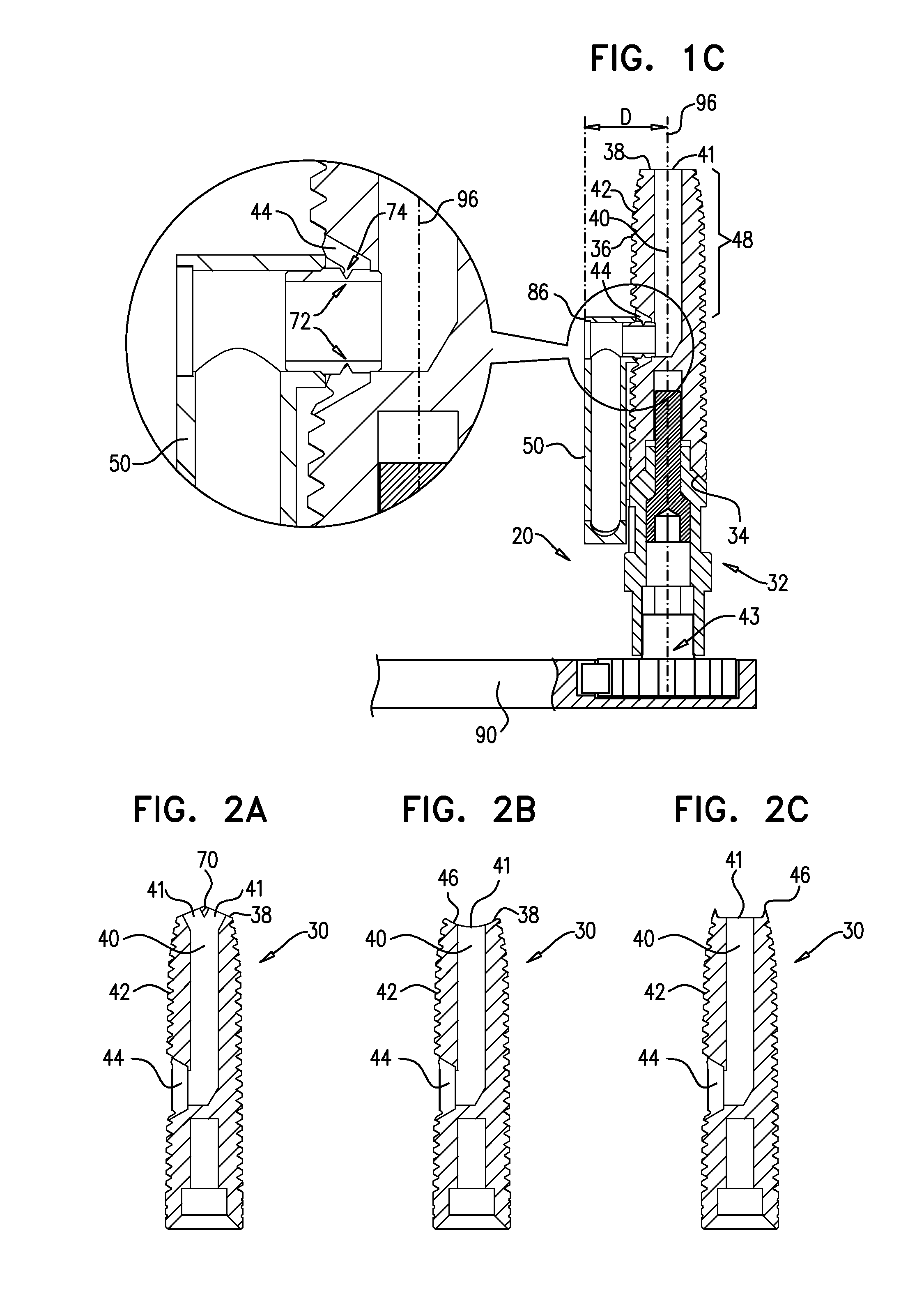 Implants, tools, and methods for sinus lift and lateral ridge augmentation