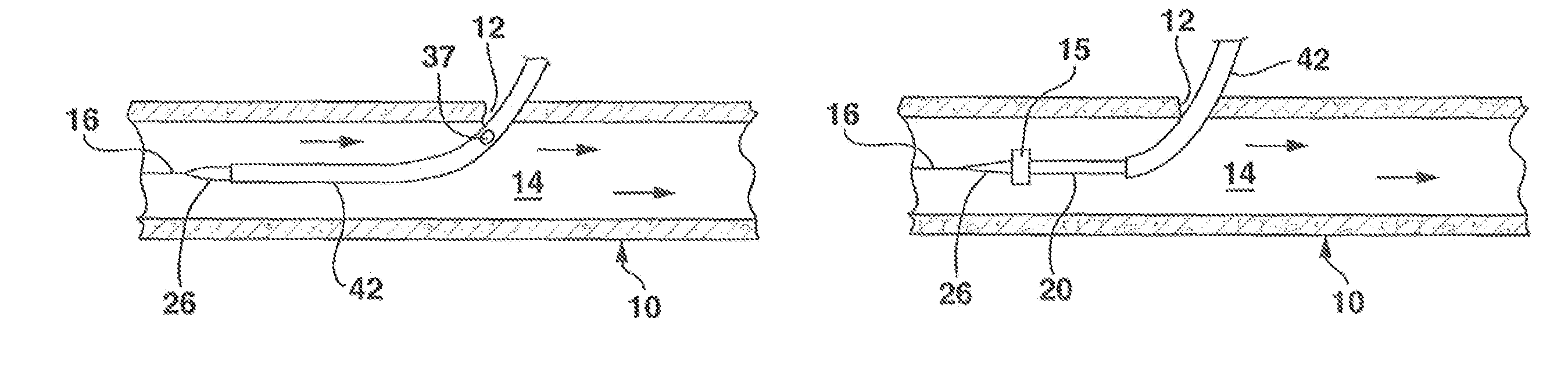 Systems and methods for closing a percutaneous vascular puncture