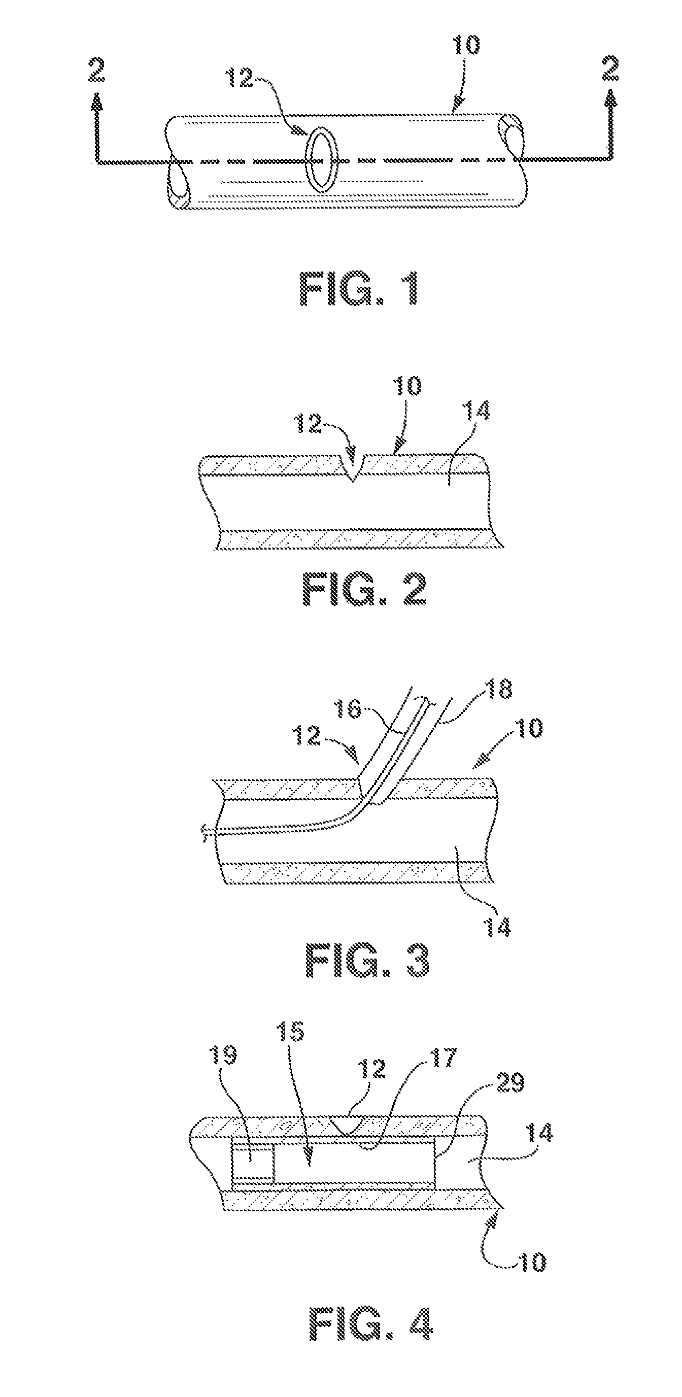 Systems and methods for closing a percutaneous vascular puncture