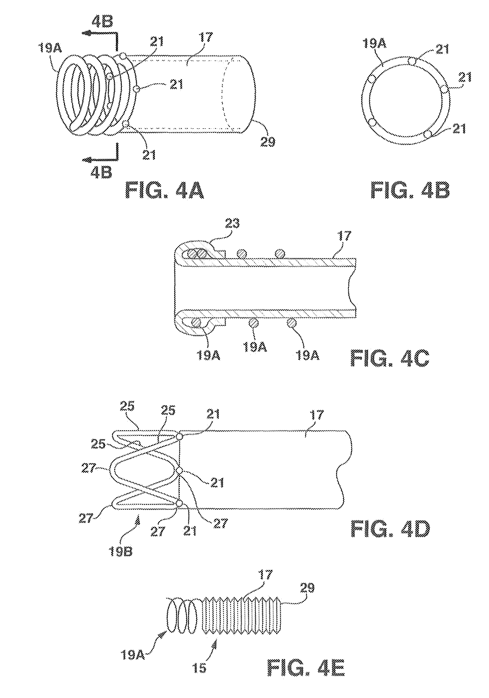 Systems and methods for closing a percutaneous vascular puncture